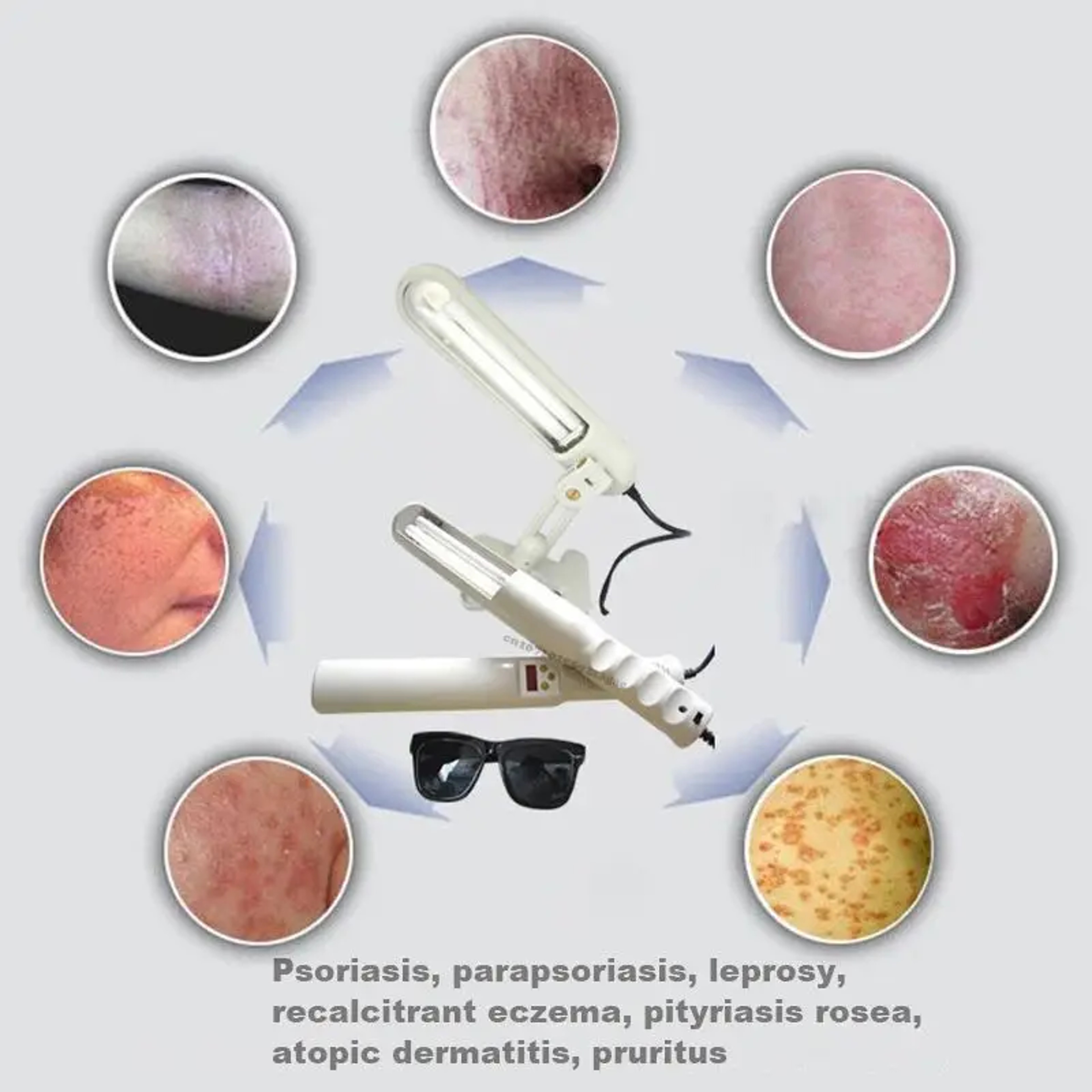 UV 311nm Ultraviolet Phototherapy Device Uses Philips Lamp UVB To Treat Vitiligo Psoriasis White Sp 0