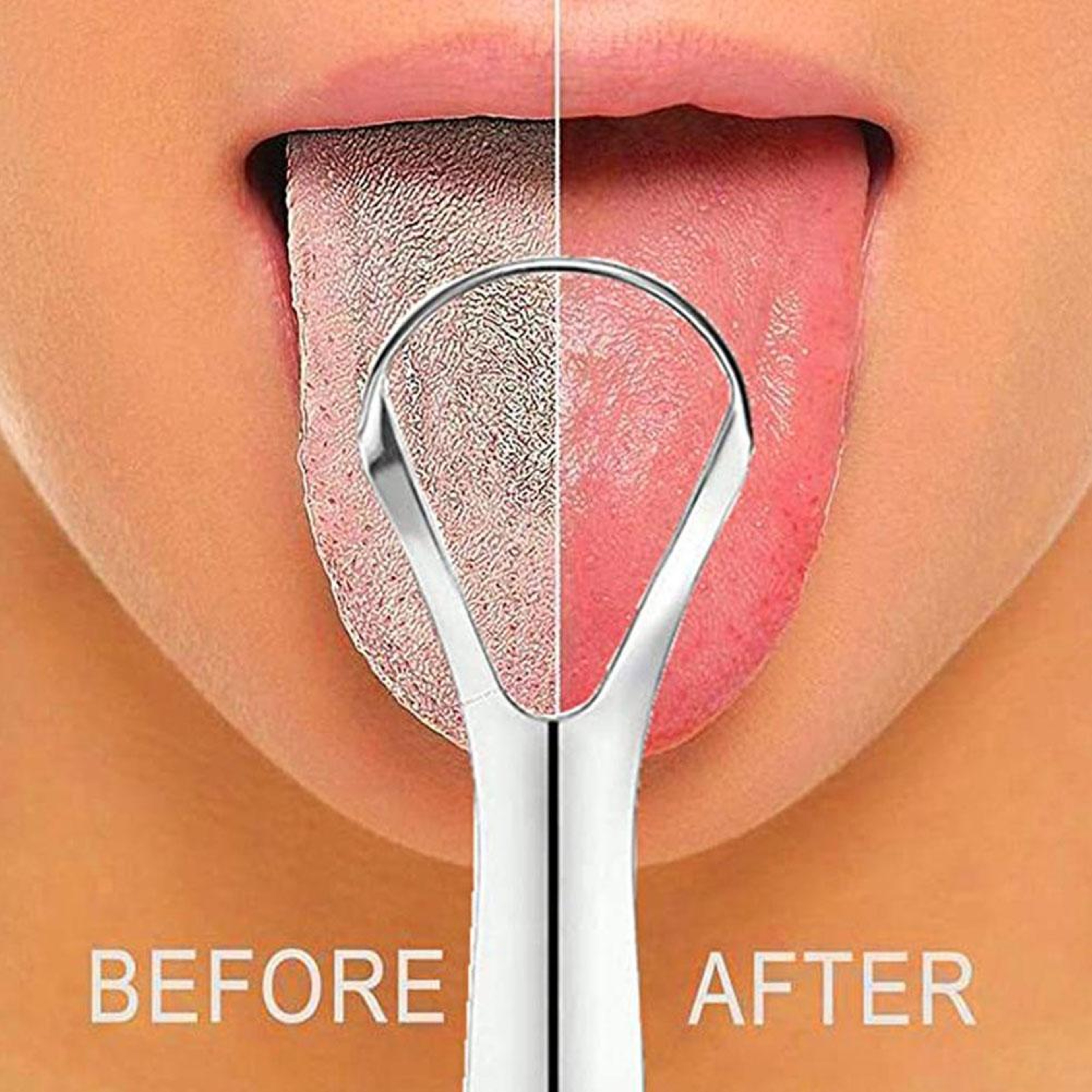 Fresh Breath Stainless Steel Tongue Scraper – view 1