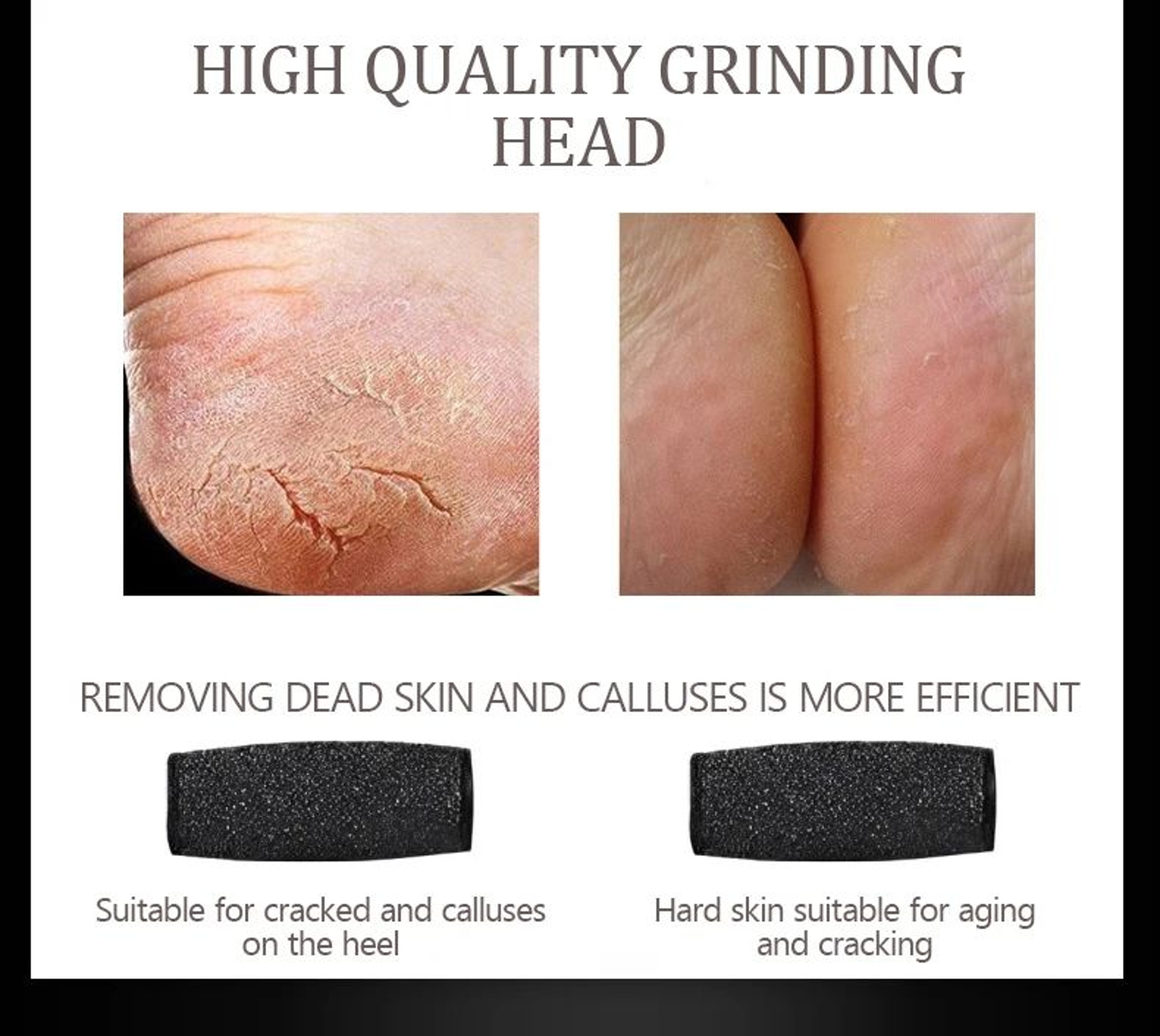 Electric Foot File Callus Remover  Foot Care Pedicure Machine For Hard Dry Skin Dead Skin  Cracked  10
