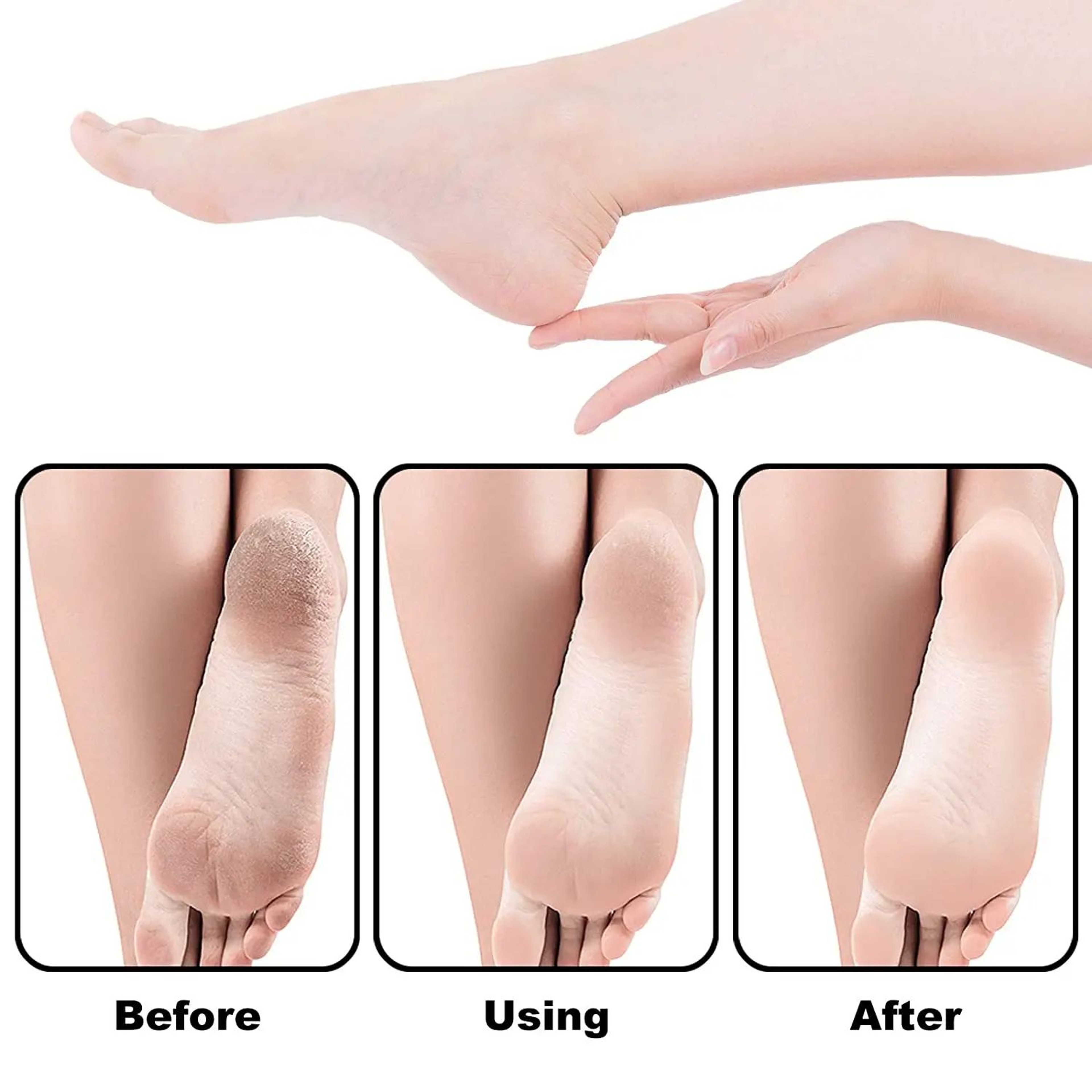 11 Pcs Pedicure Foot File Kit  Metal Handle Callus Remover Rasp With Coarse And Fine Grit Sanding R 3