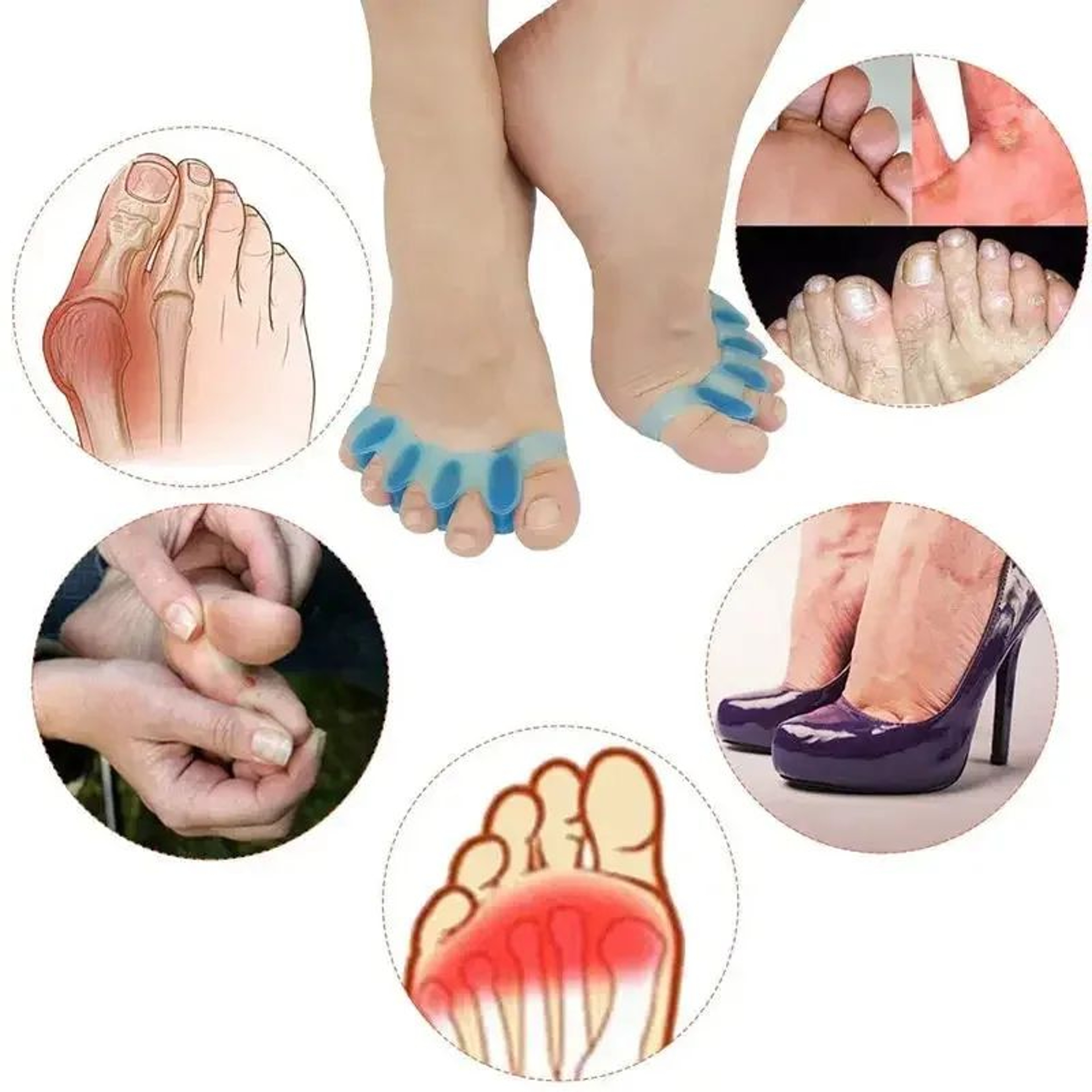 2Pair Gel Toe Separator  Bunion Corrector  Soft Silicone Toe Spacers  Hammer Toe Straightener 0