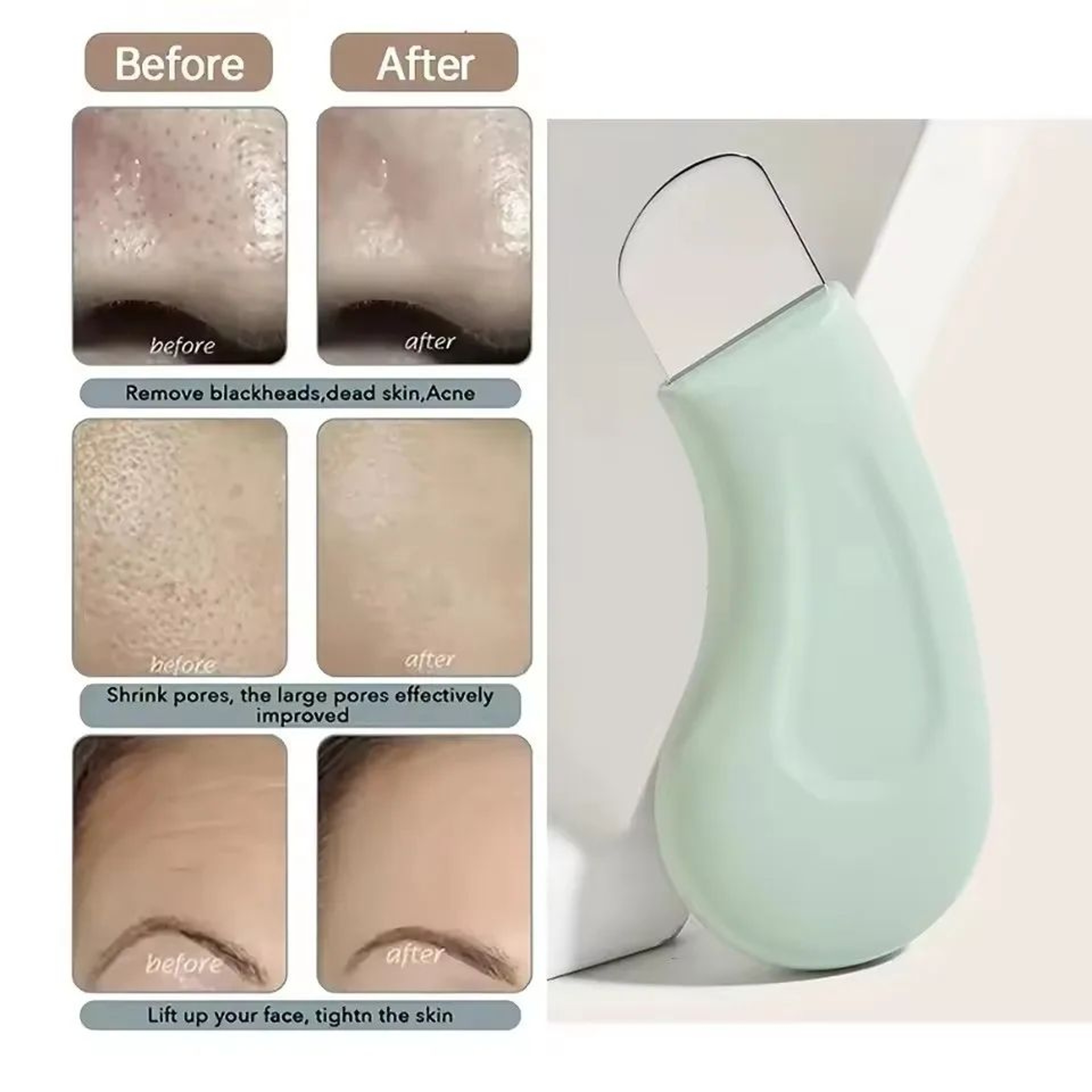 Deep Cleansing Blackhead  Whitehead Removal Tool  Stainless Steel Skin Pore Cleaner For Nose Face   0