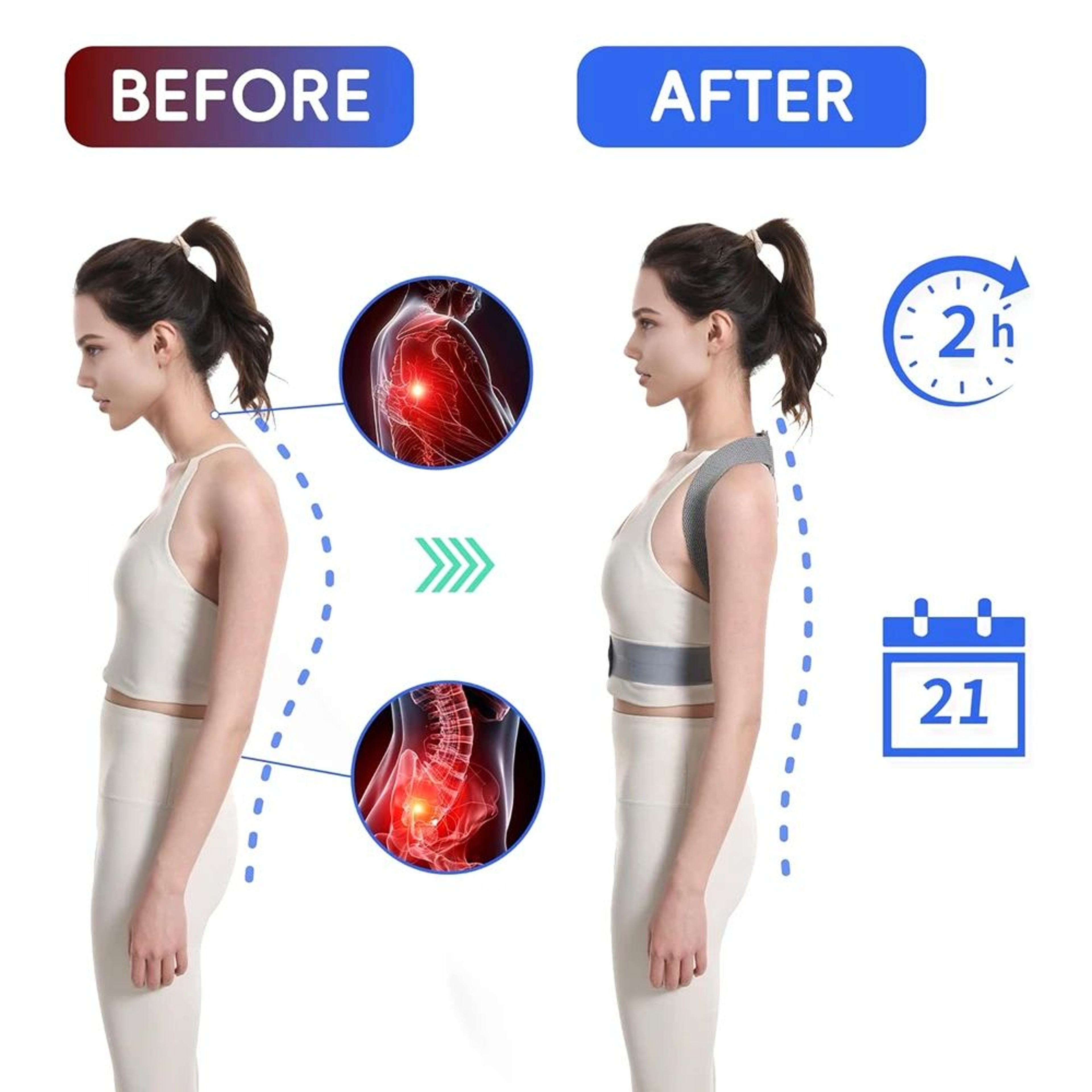 Posture Corrector For Women  Men  Adjustable Back Brace For Upper Back Neck  Shoulder Support Scoli 2