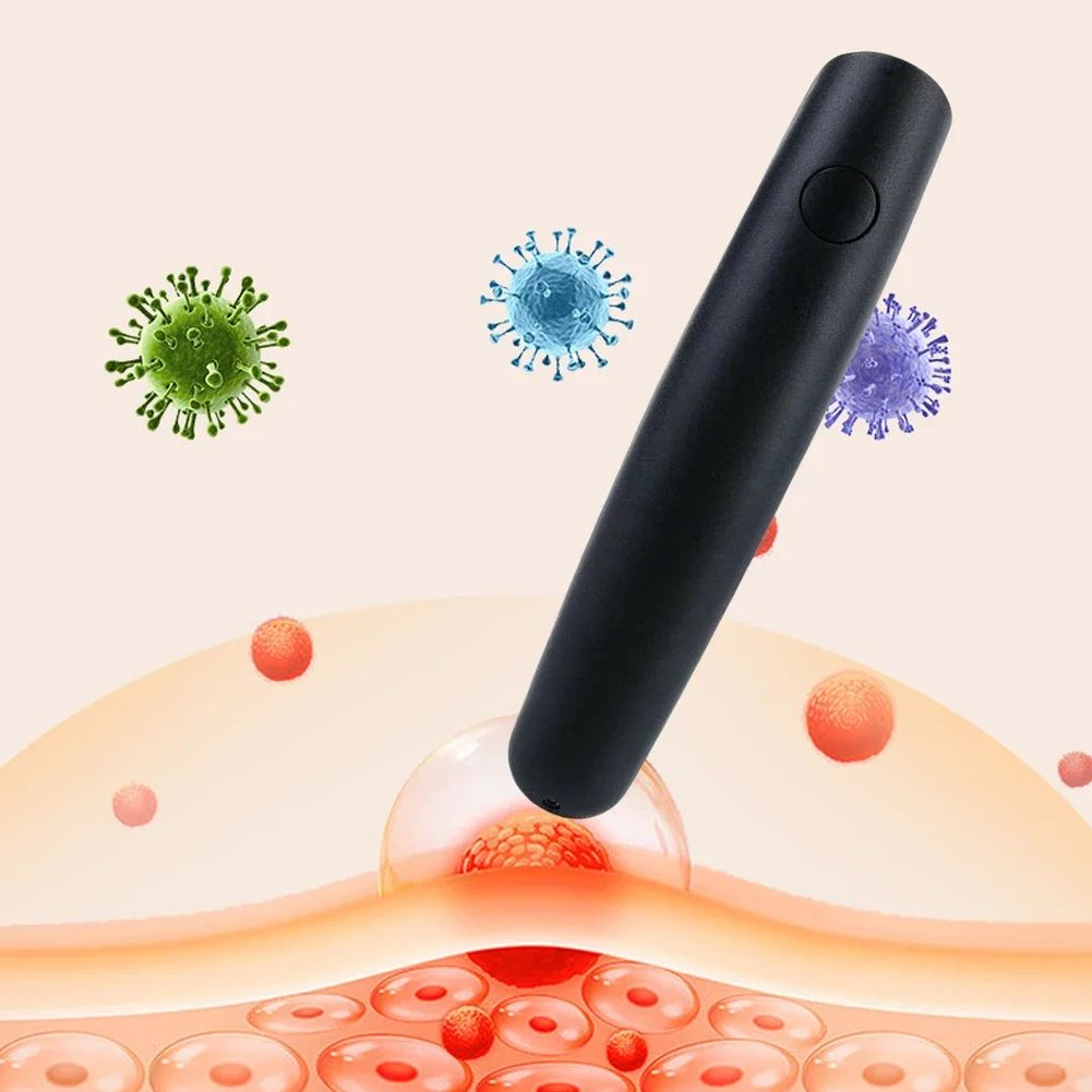 Electronic Insect Bite Healer Pen  Heat Pulse Mosquito Bite Relief Stick For Itching  Bug Bites 2