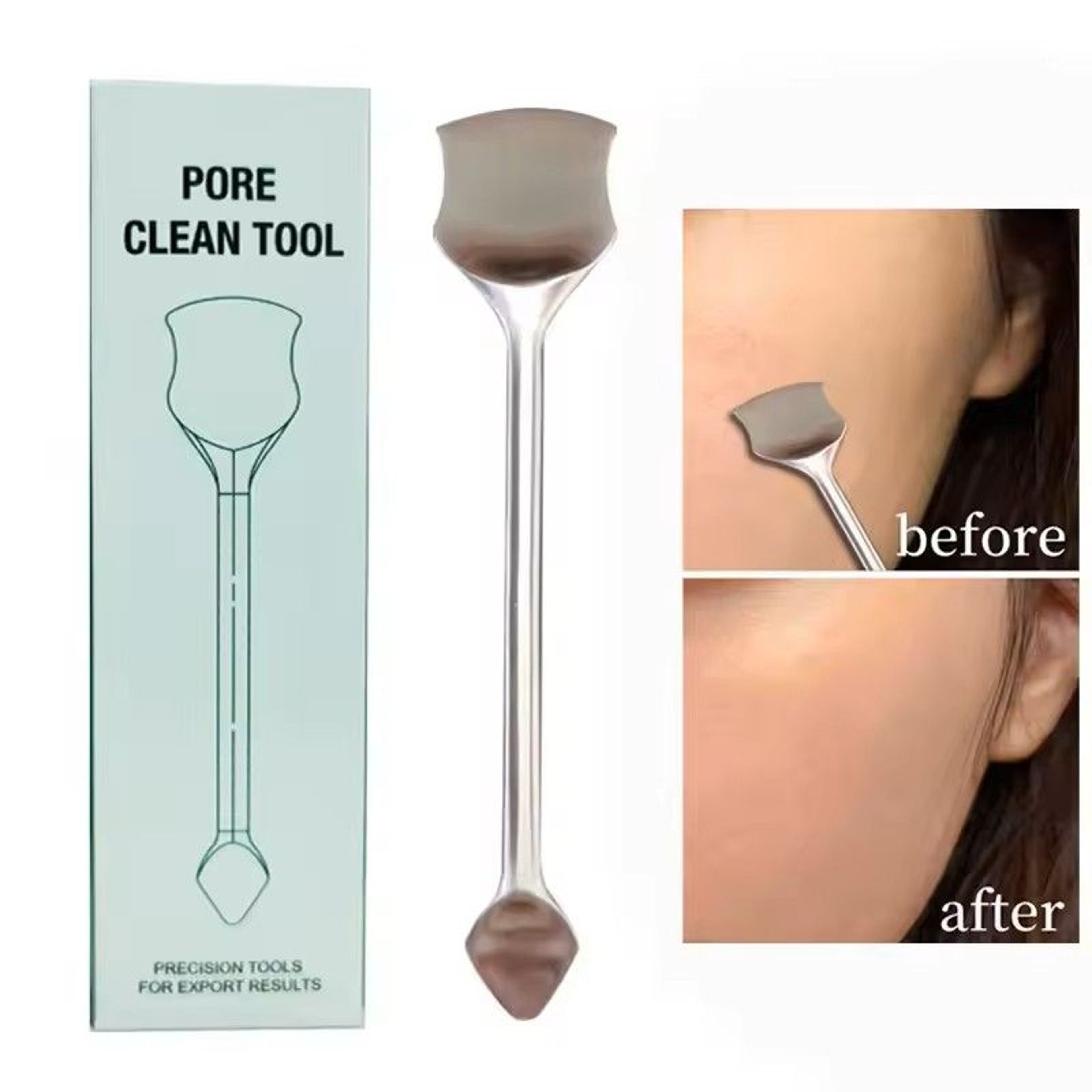 304 Stainless Steel Blackhead Cleaning Scraper Double Head Pimple Remover Facial Care Beauty Tool 0