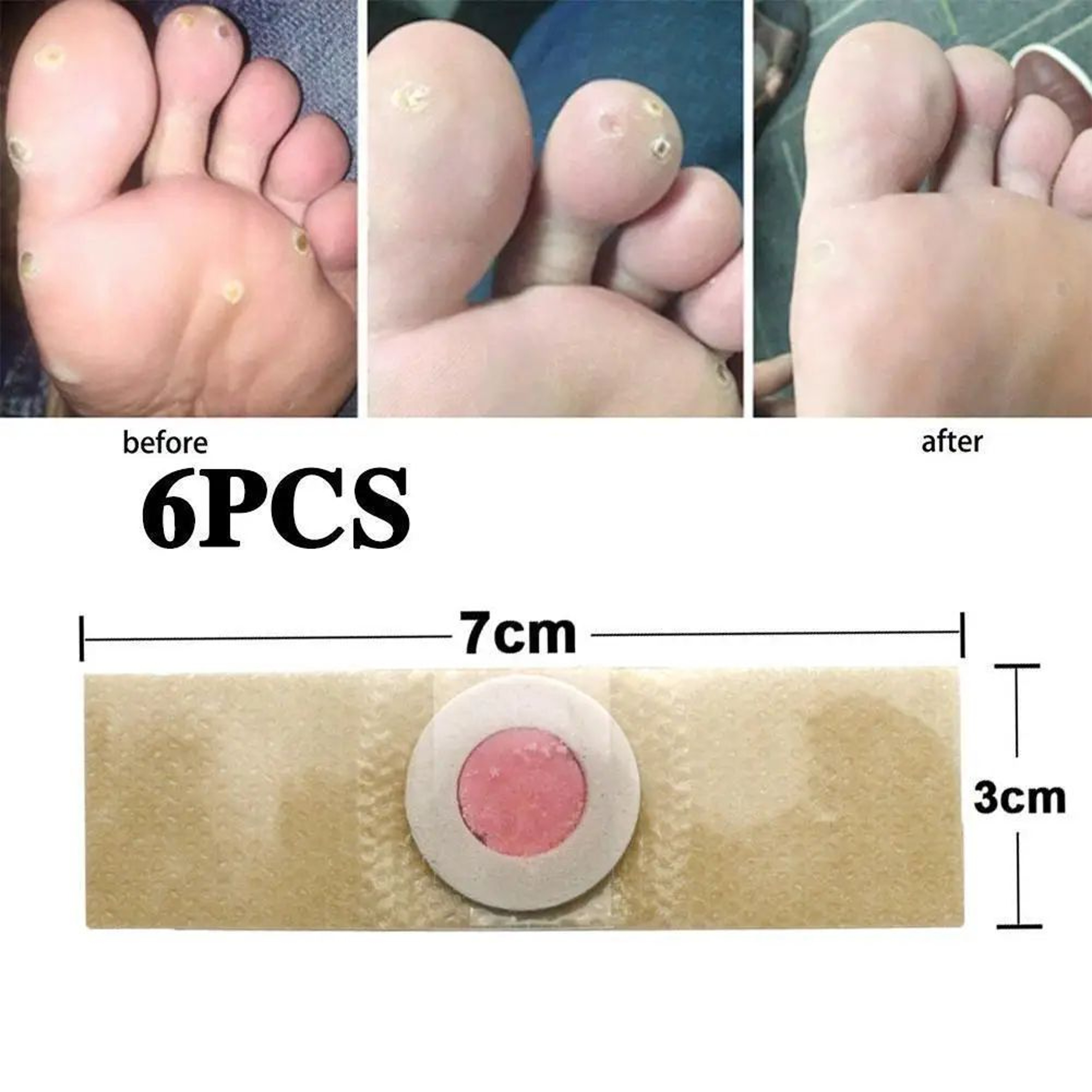 6 Pcs Foot Corn And Callus Protector Pads 1