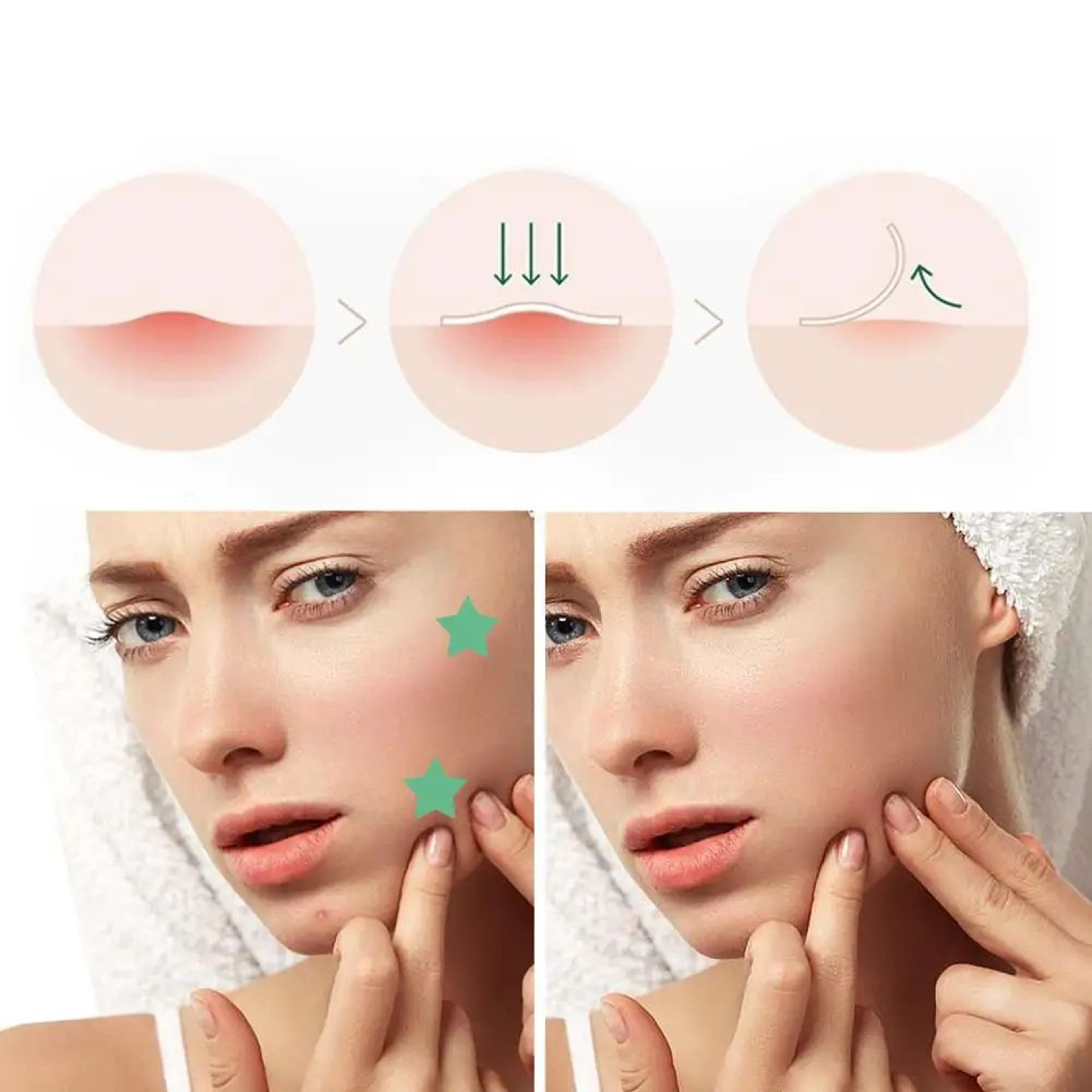 Star And Heart Acne Patch Stickers 4