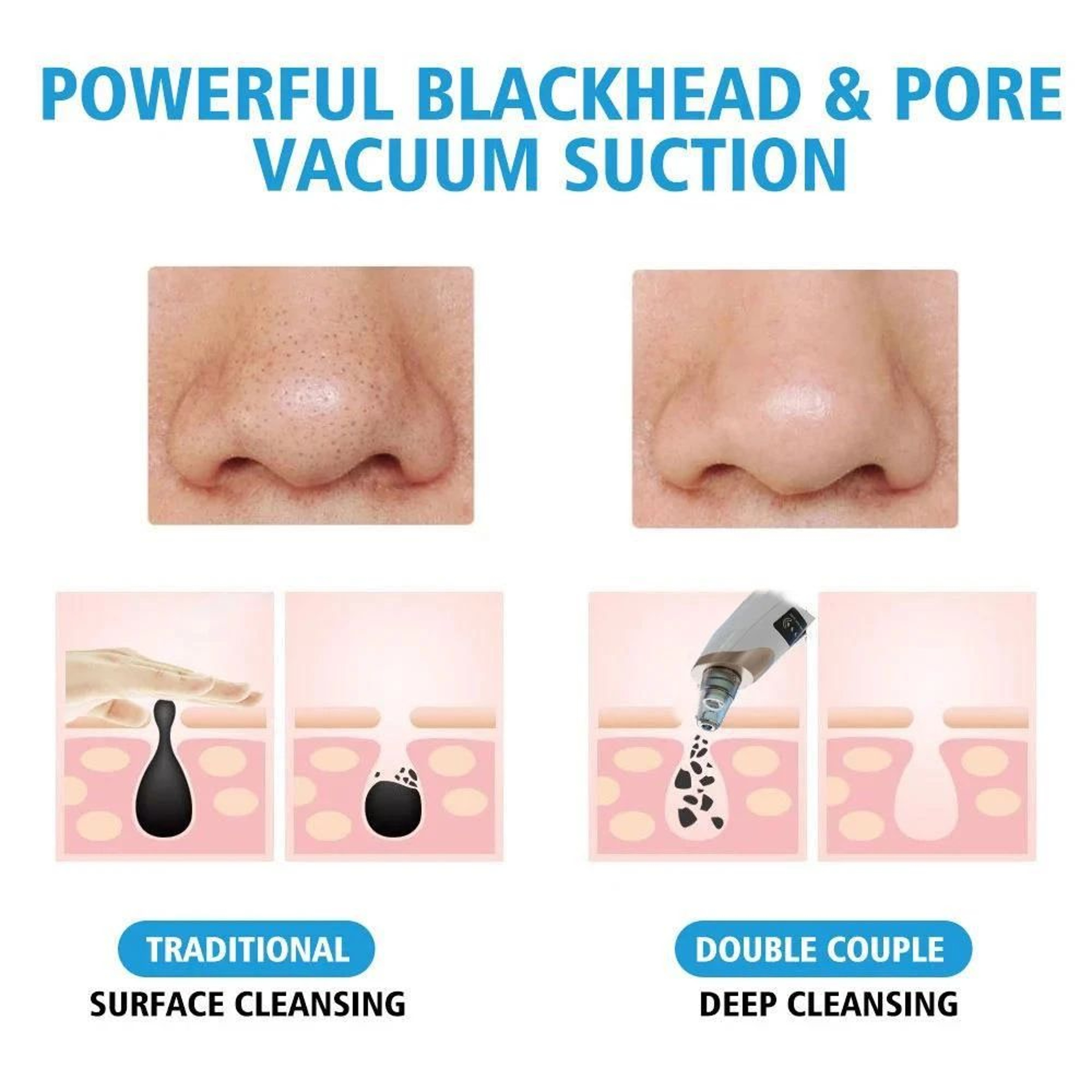 Electric Facial Blackhead Vacuum Cleaner 1