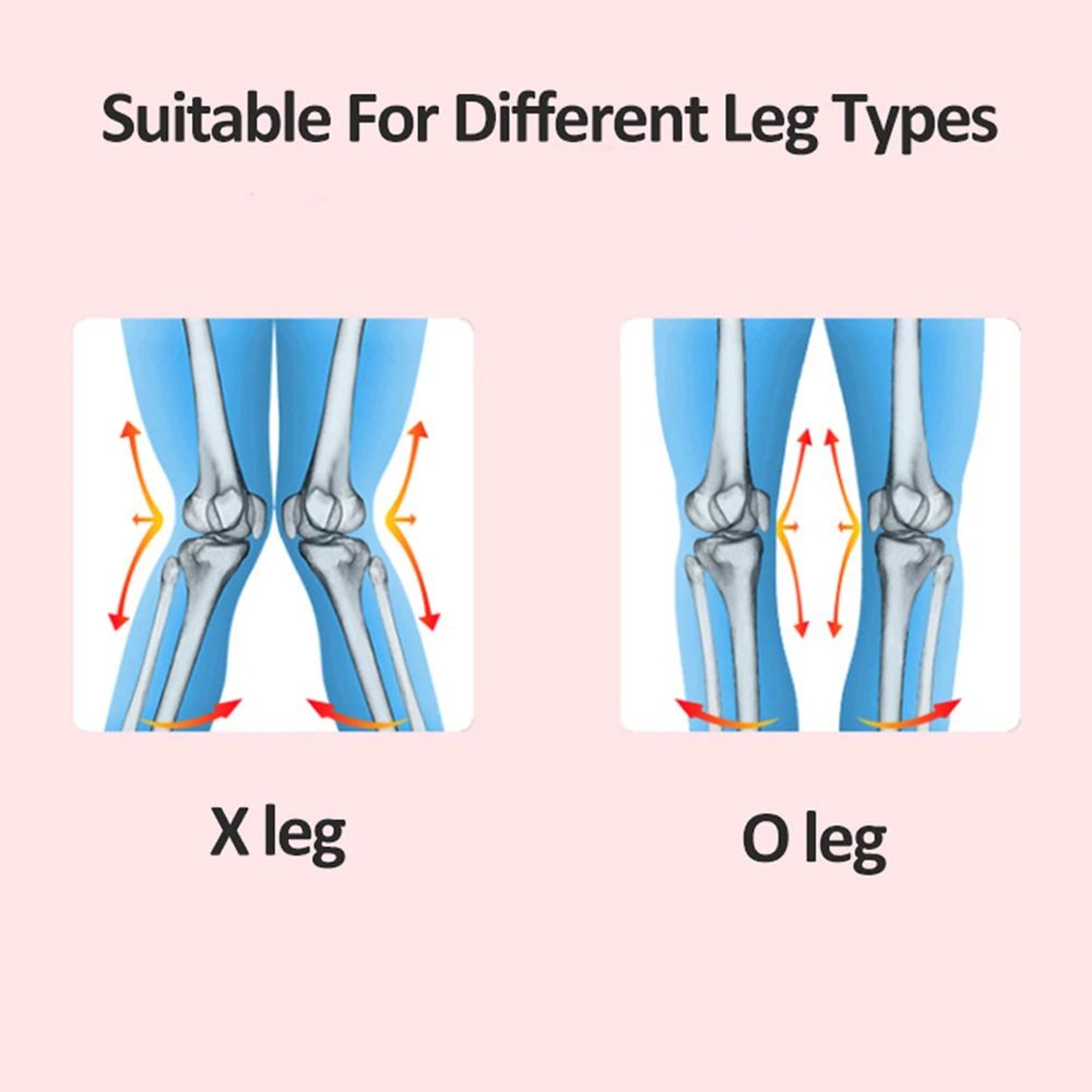 Leg Straightening OX Type Knee Valgum Correction Belt 10
