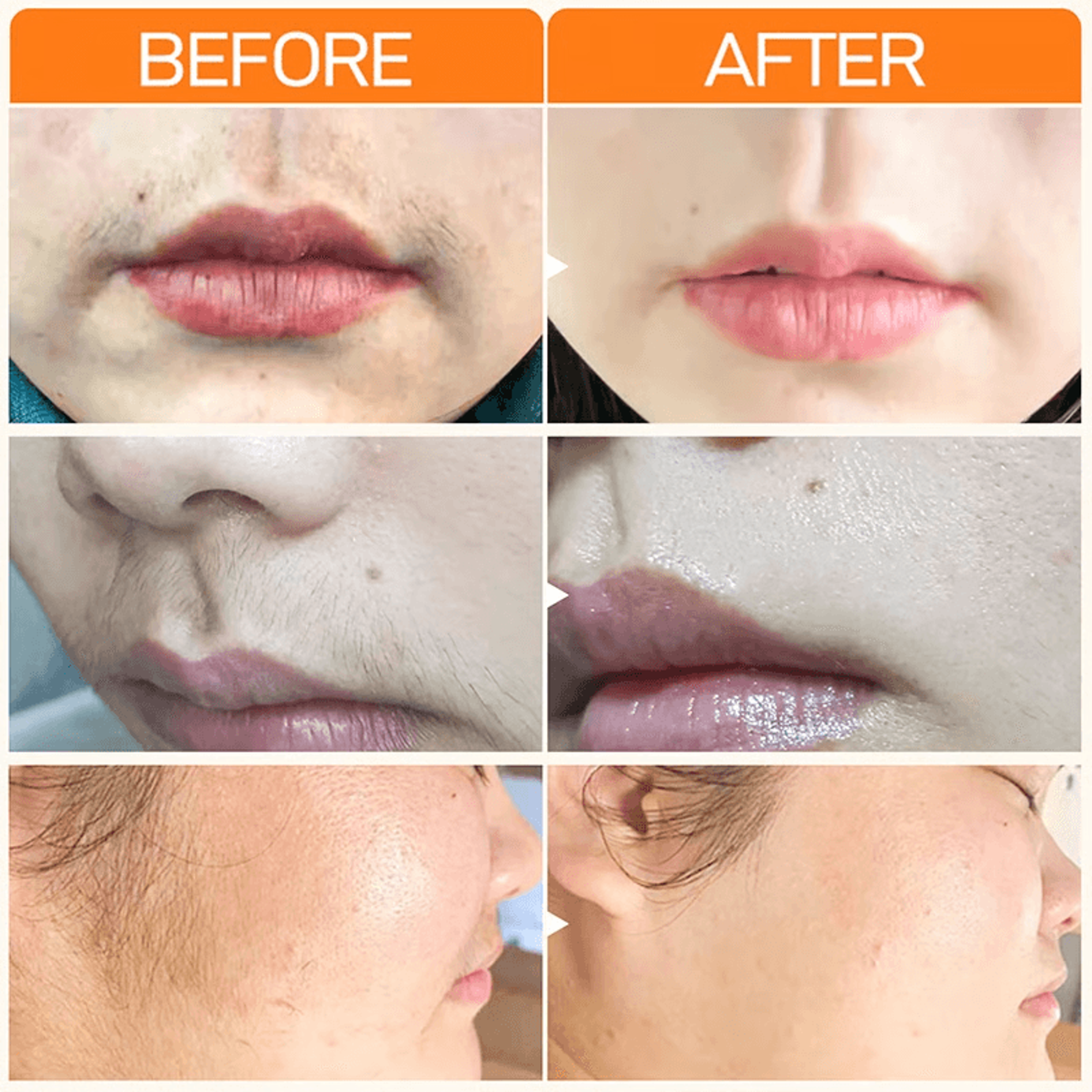 Fast Hair Removal Cream For Women Painless  Whitening Skin Hydrating Formula 2