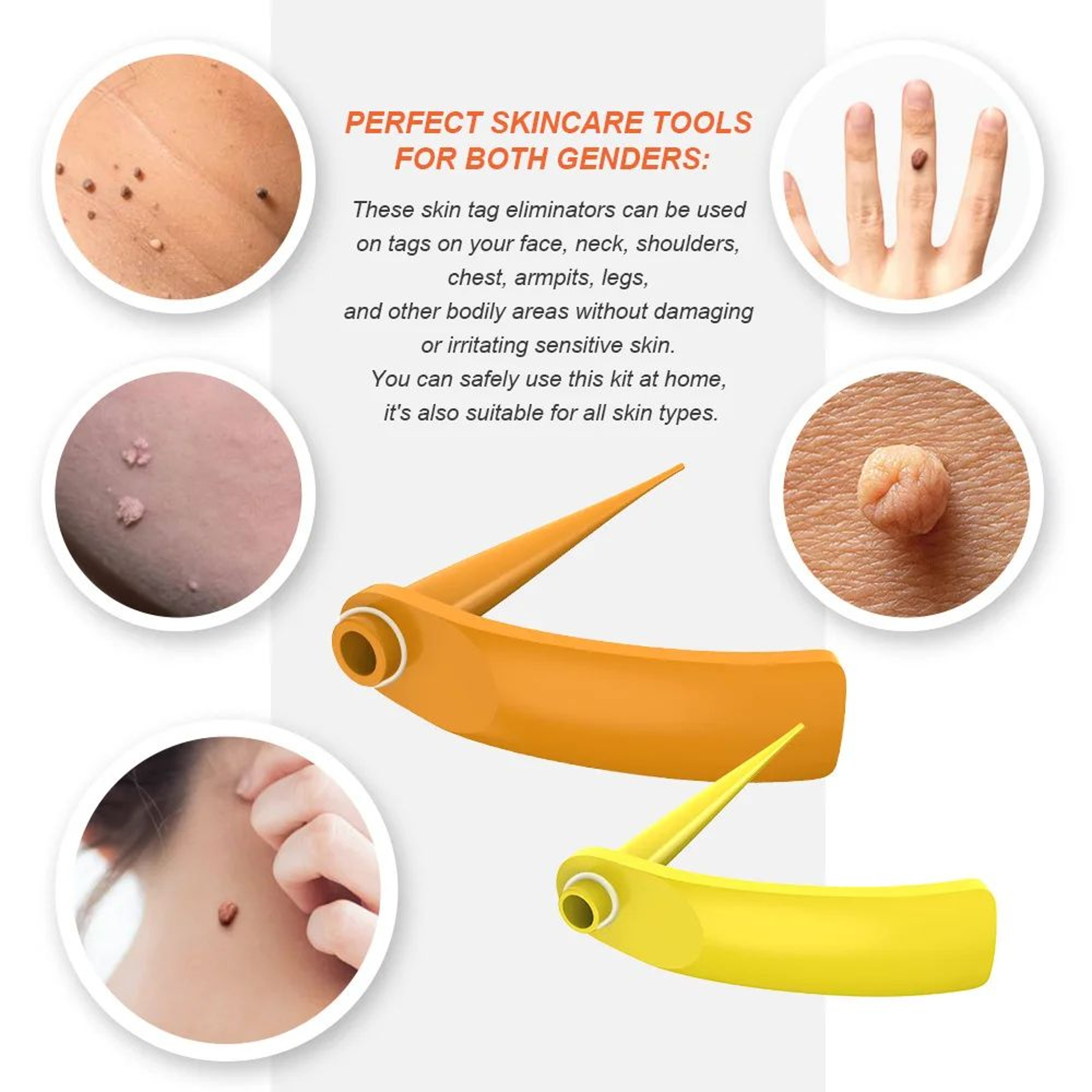 2 In 1 Electric Skin Tag Removal Pen Kit 5