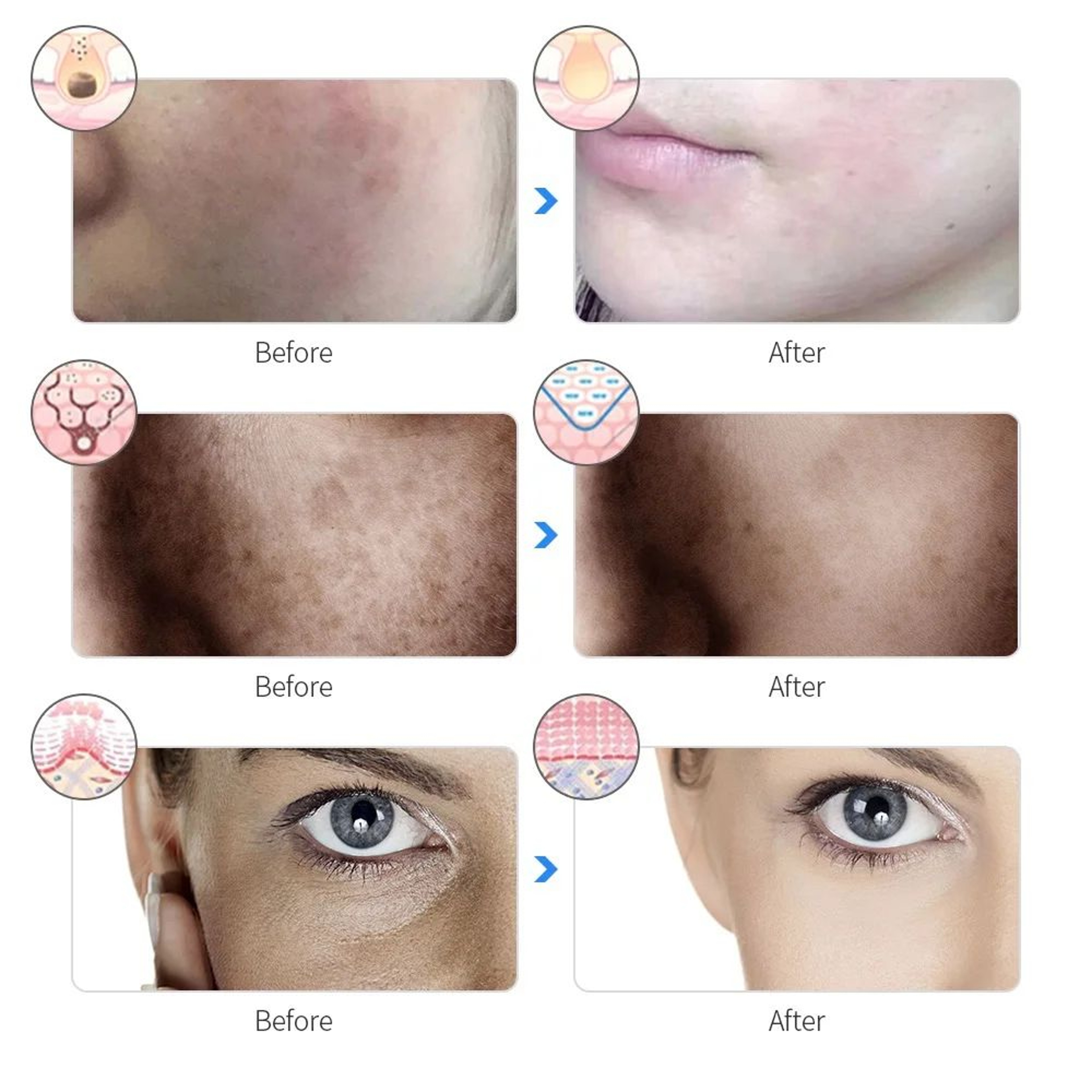 7 Color LED Photon Facial Mask Wireless Light Therapy Device 8