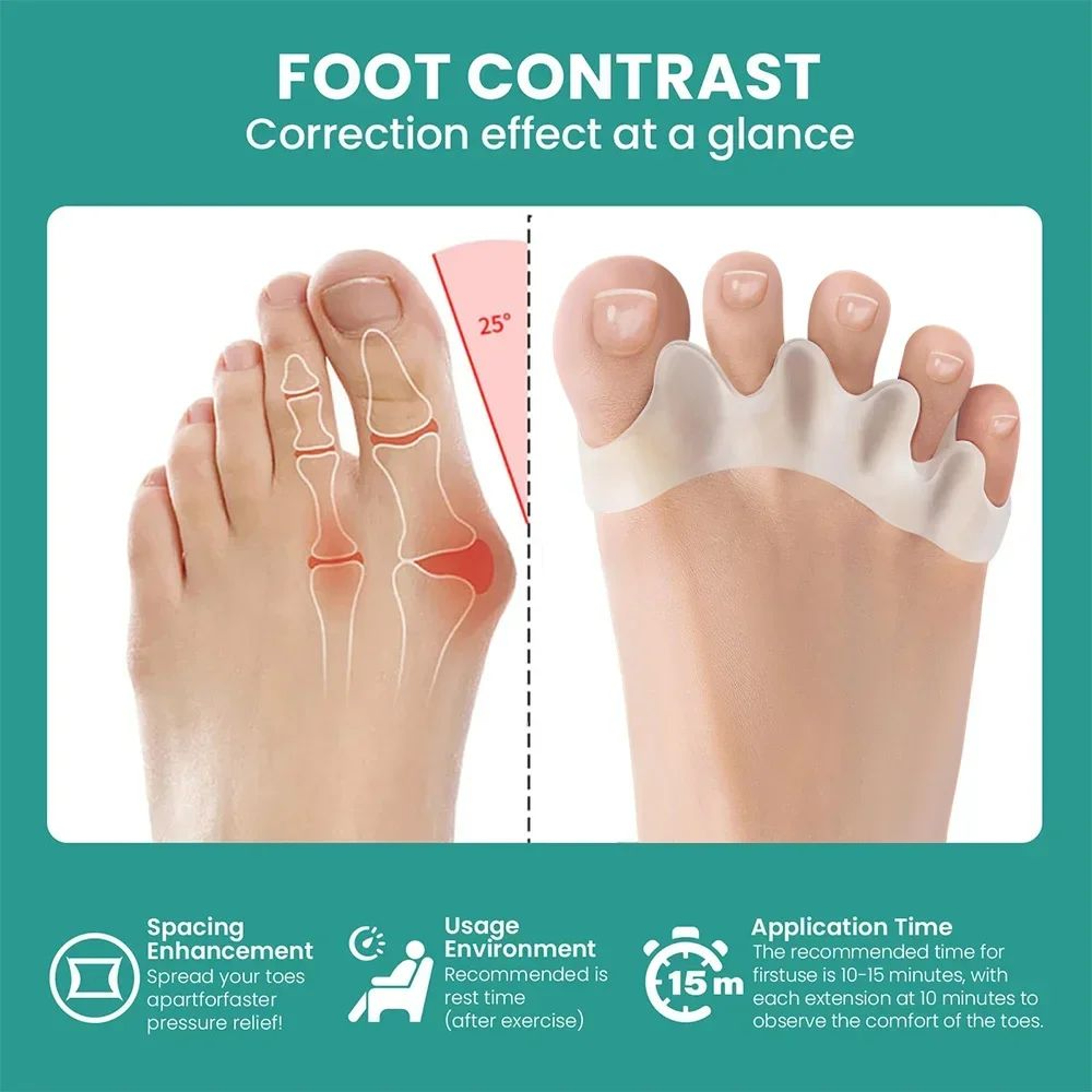 ComfortAlign Silicone Toe Separator  Bunion Corrector For Hammer Toe Relief 2
