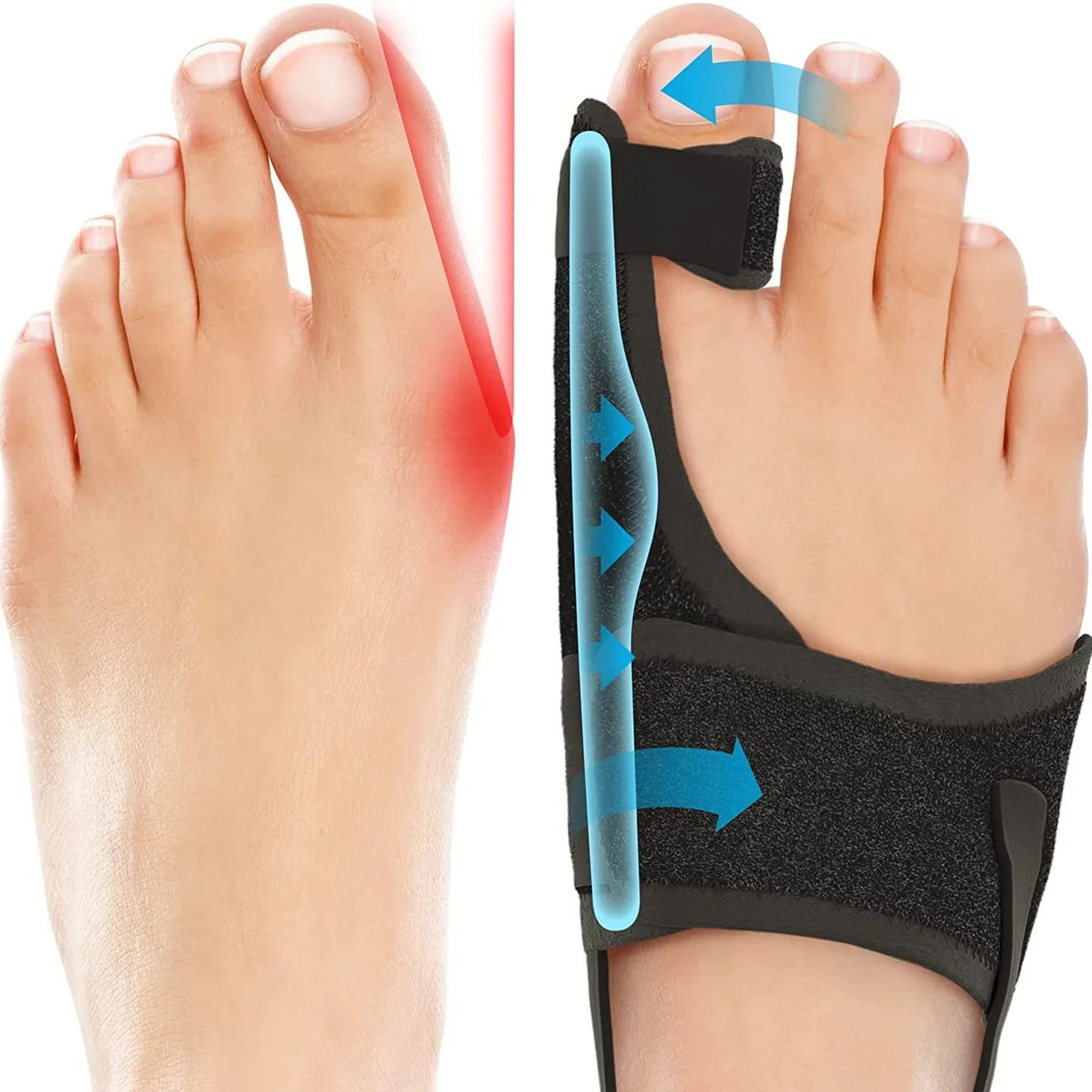 ErgoAlign Bunion Corrector Toe Separator  Hallux Valgus Splint 0