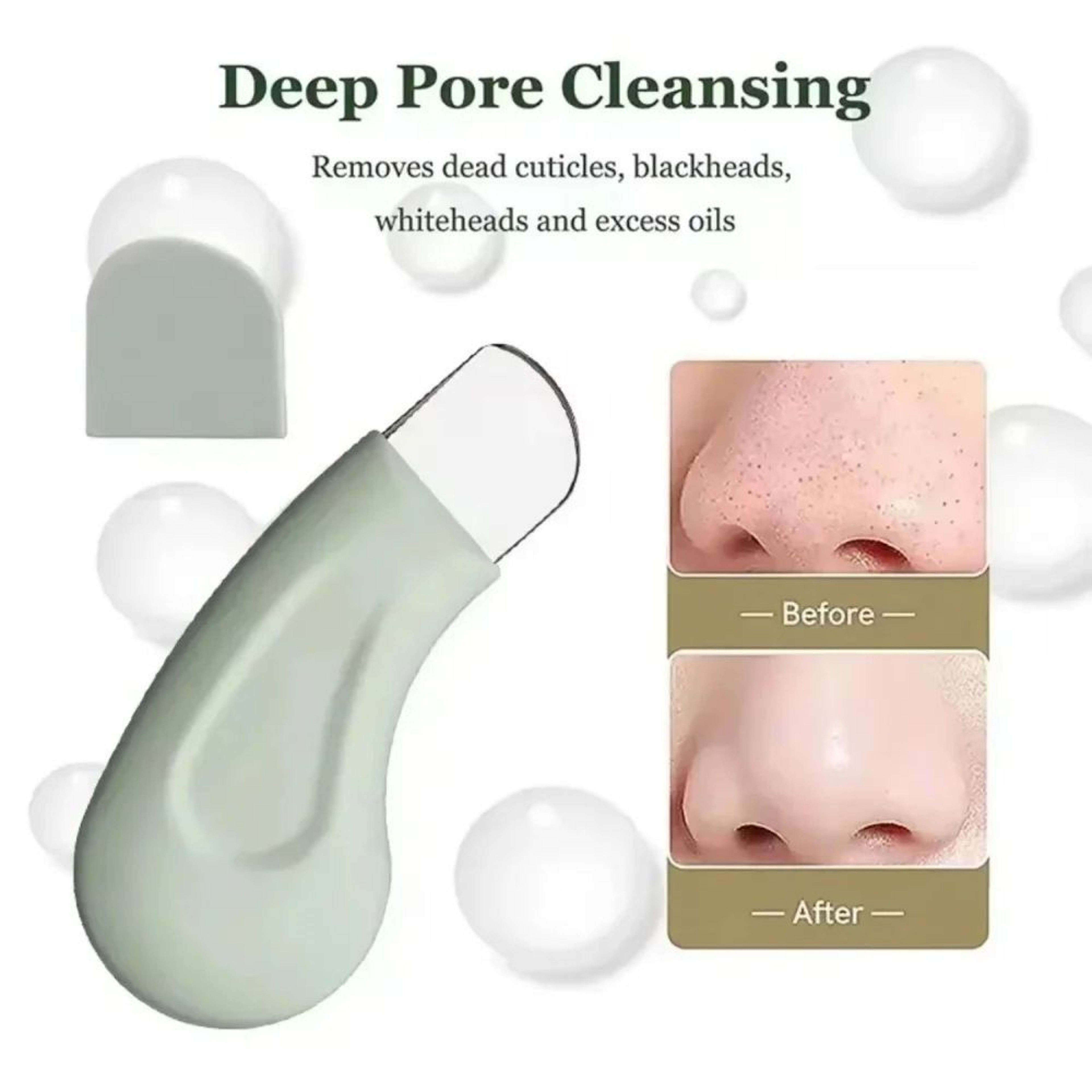 Gentle Blackhead Remover Tool Silicone Facial Scraper For Deep Pore Cleaner Skin Care 0