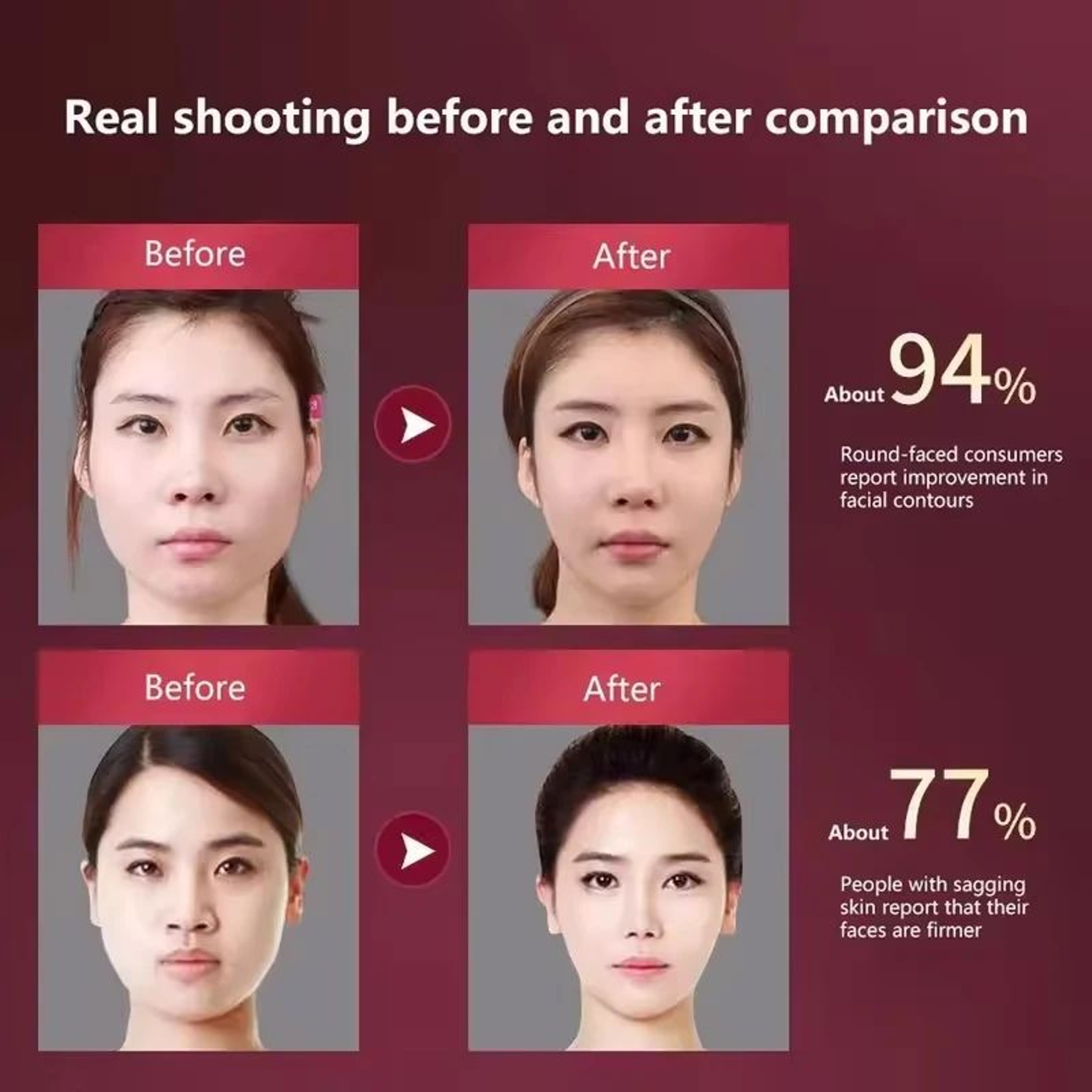 RadianceLift LED Face Massager V Face Lifting Device With Heat And Vibration 5