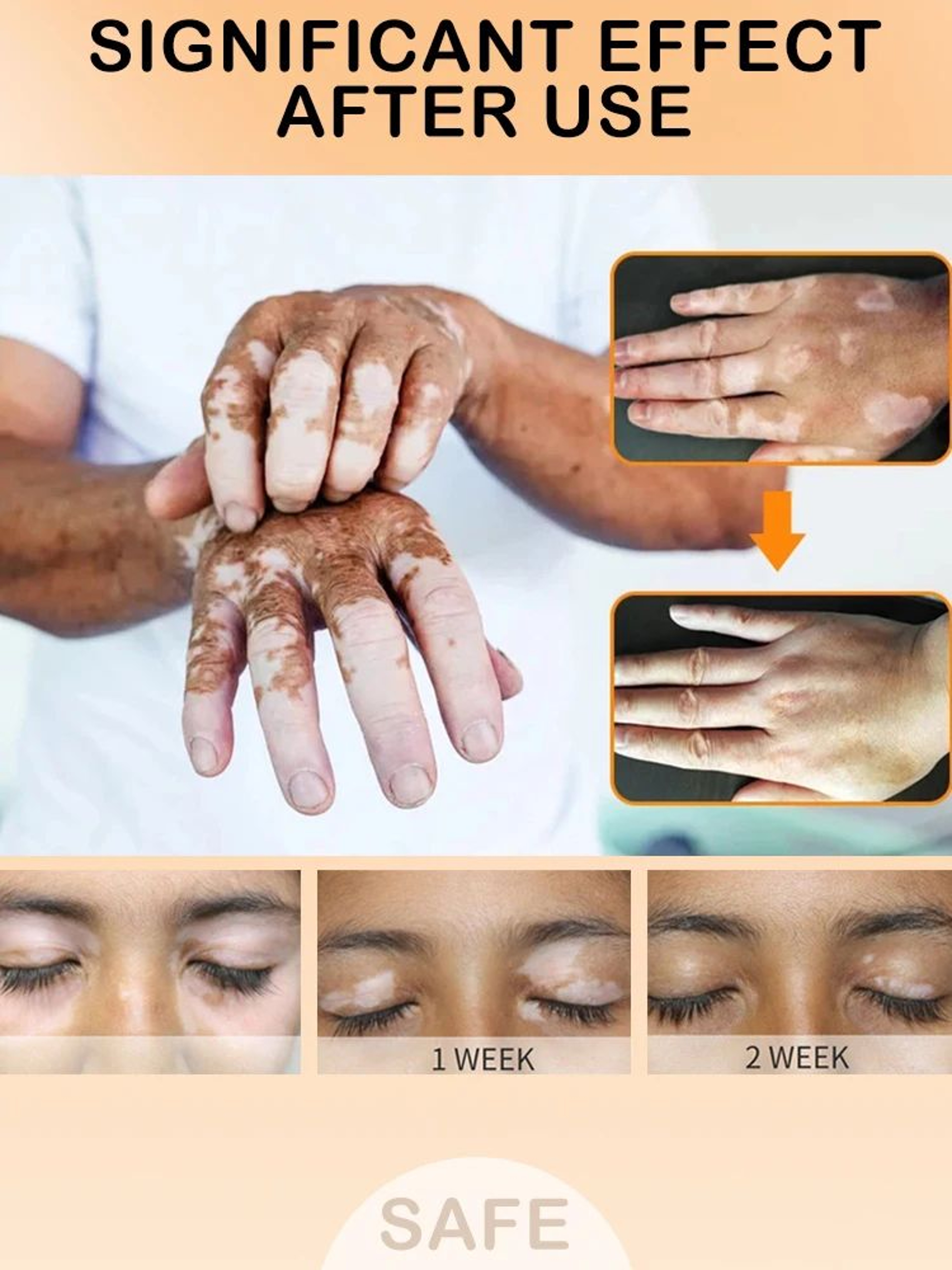Eelhoe White Spot Skin Care Cream 15g  Moisturizing Daily Care For Face And Body 1