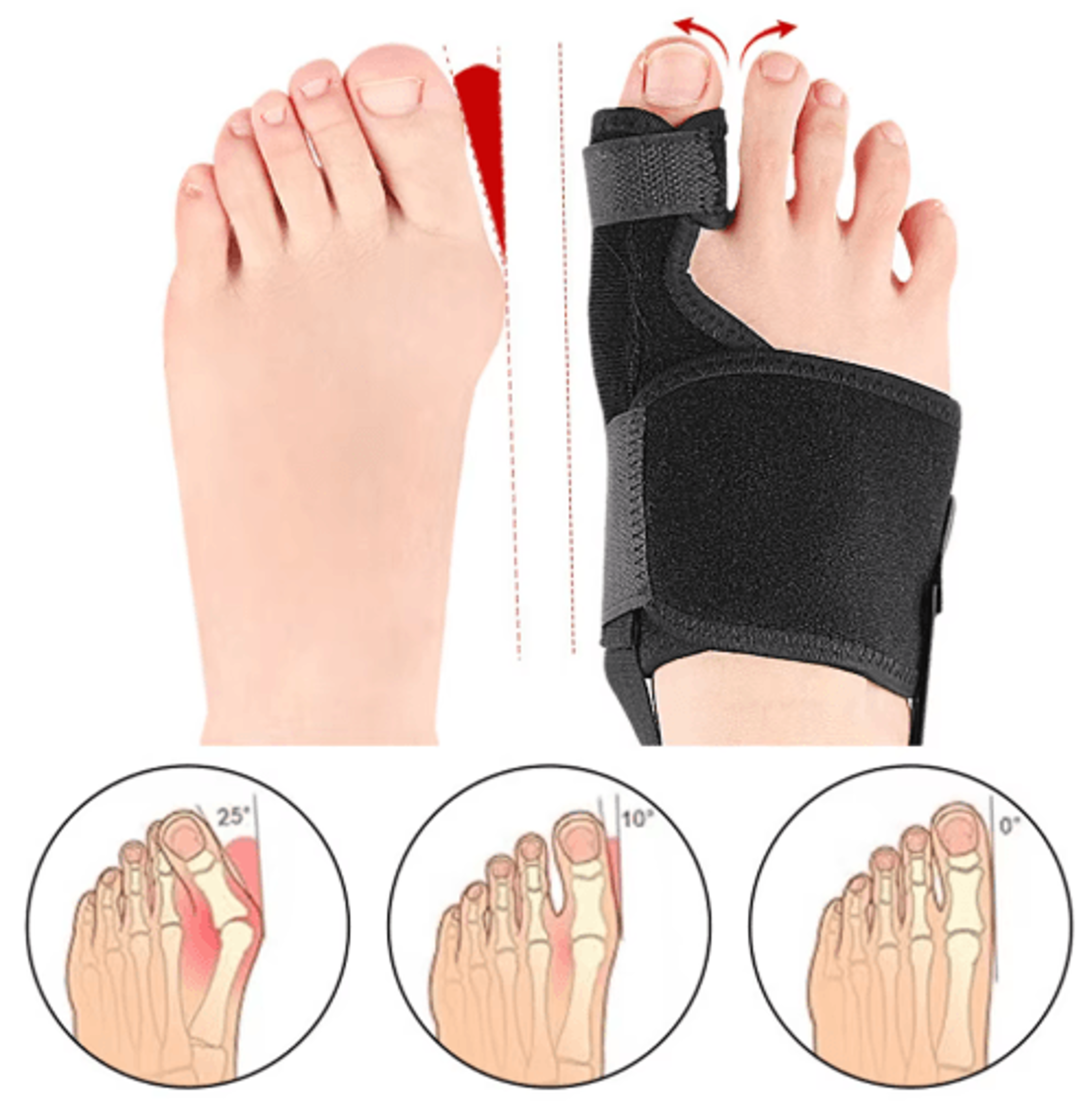 Toe Corrector Orthotic Hallux Valgus  Bunion Alignment Support Tool 3