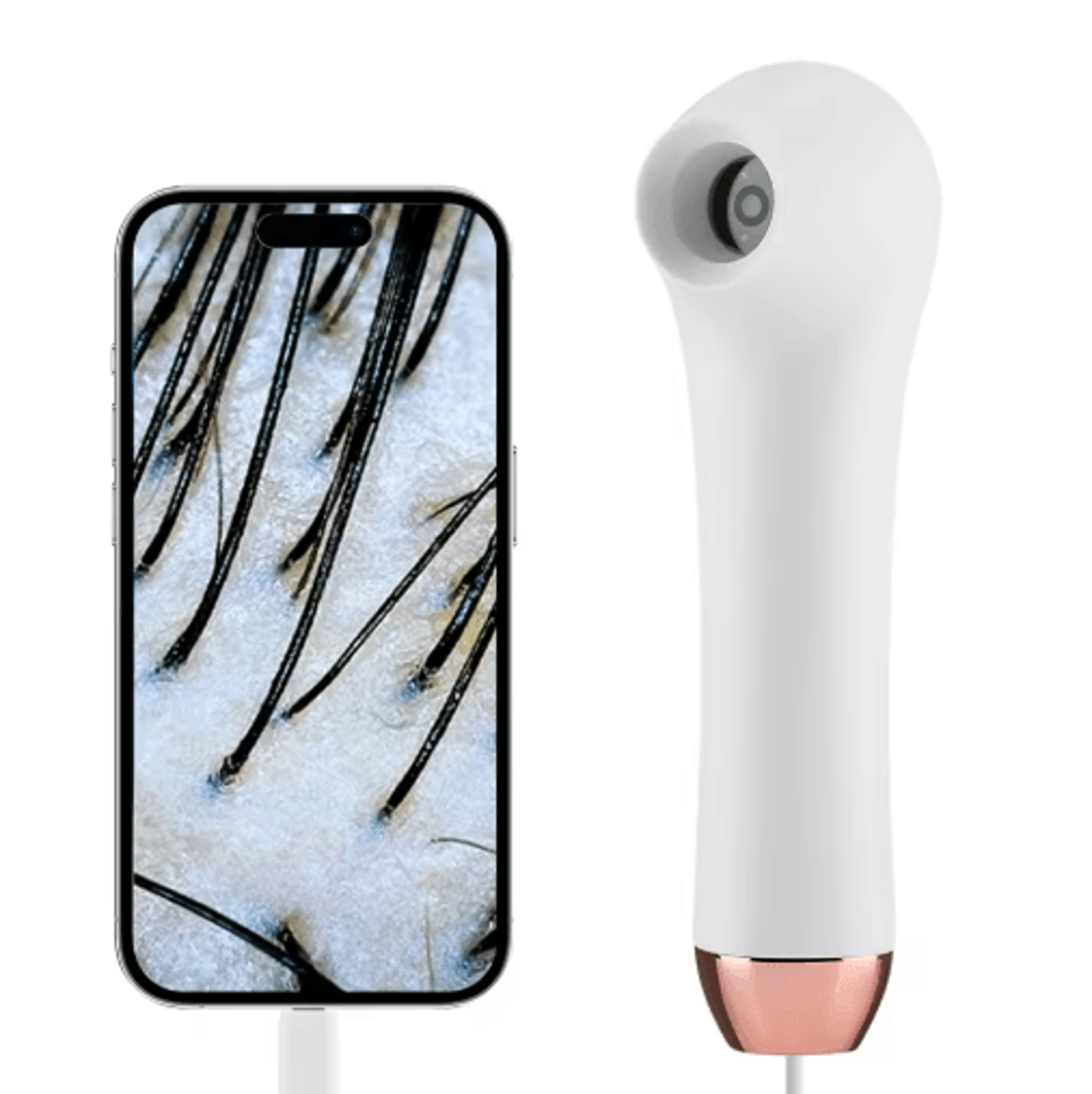 DermaScope Pro Wireless Skin Analyzer  Scalp Detection Dermatoscope 6