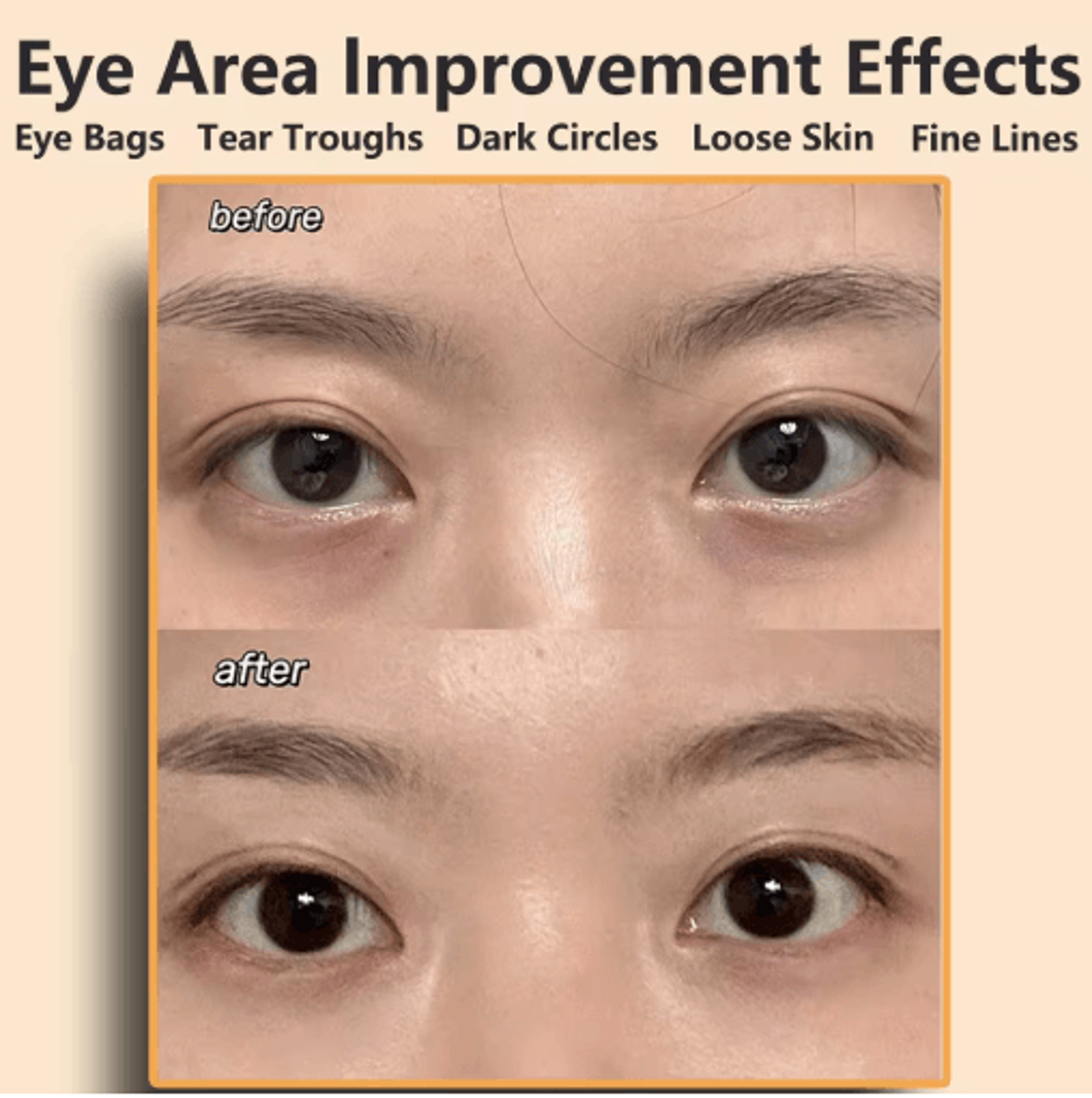 EMS Facial Massager  AntiWrinkle Face Lifting  Eye Care Device 11