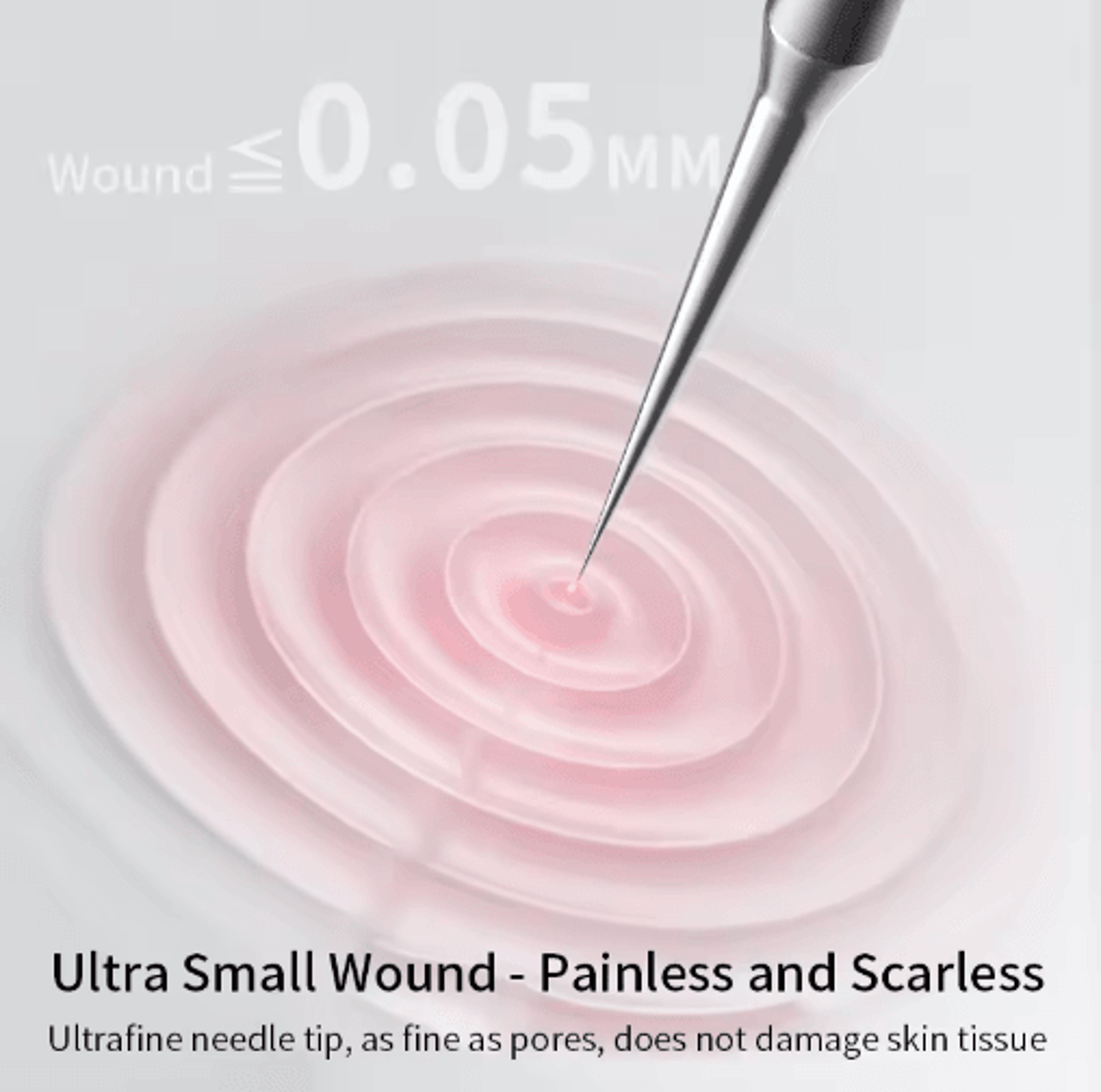UltraFine Blackhead  Whitehead Removal Tool  Precision Acne Extractor For Deep Pore Care 6