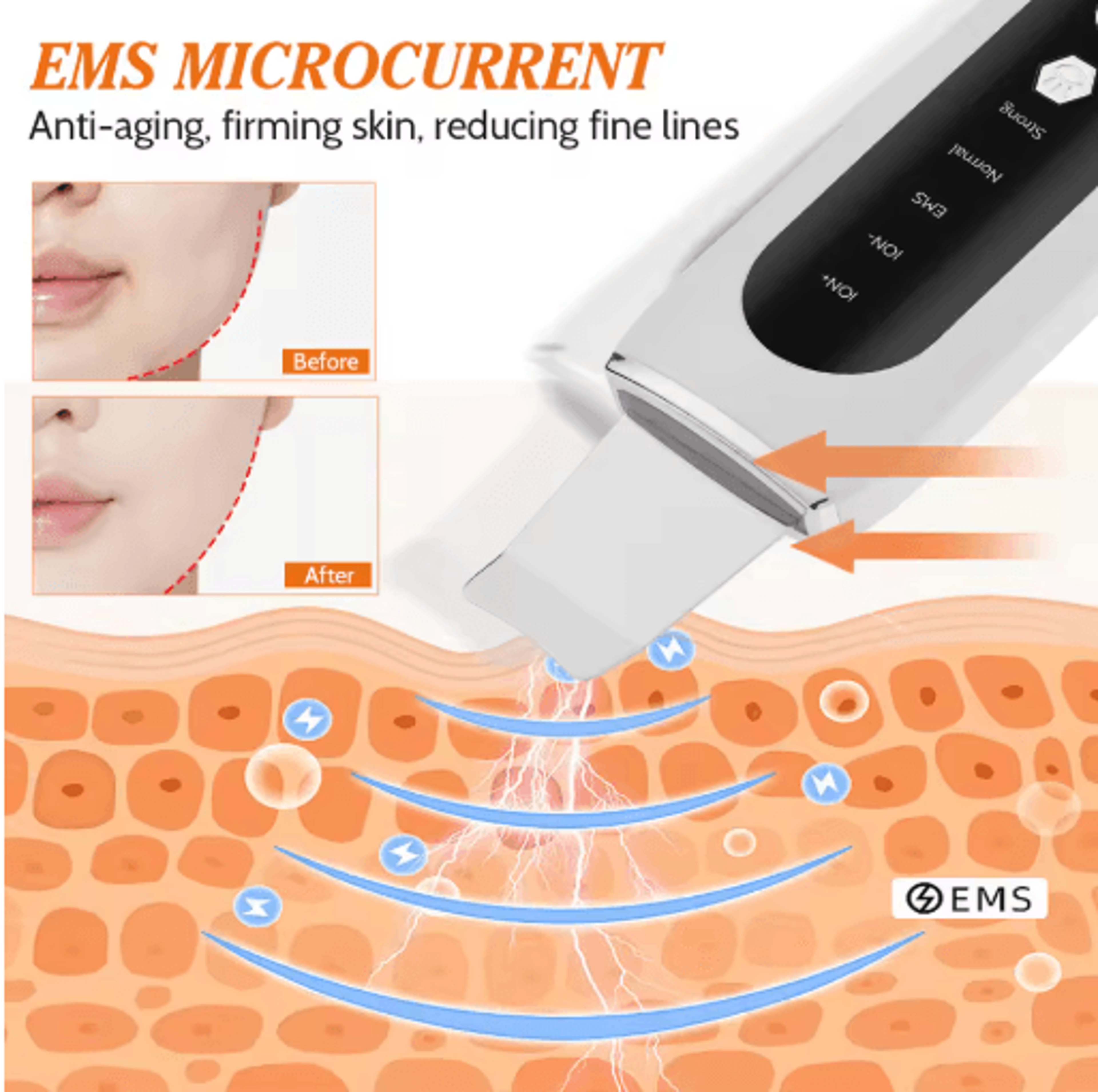 Ultrasonic Skin Scrubber  Deep Cleansing Blackhead Remover  Facial Pore Cleaner 6