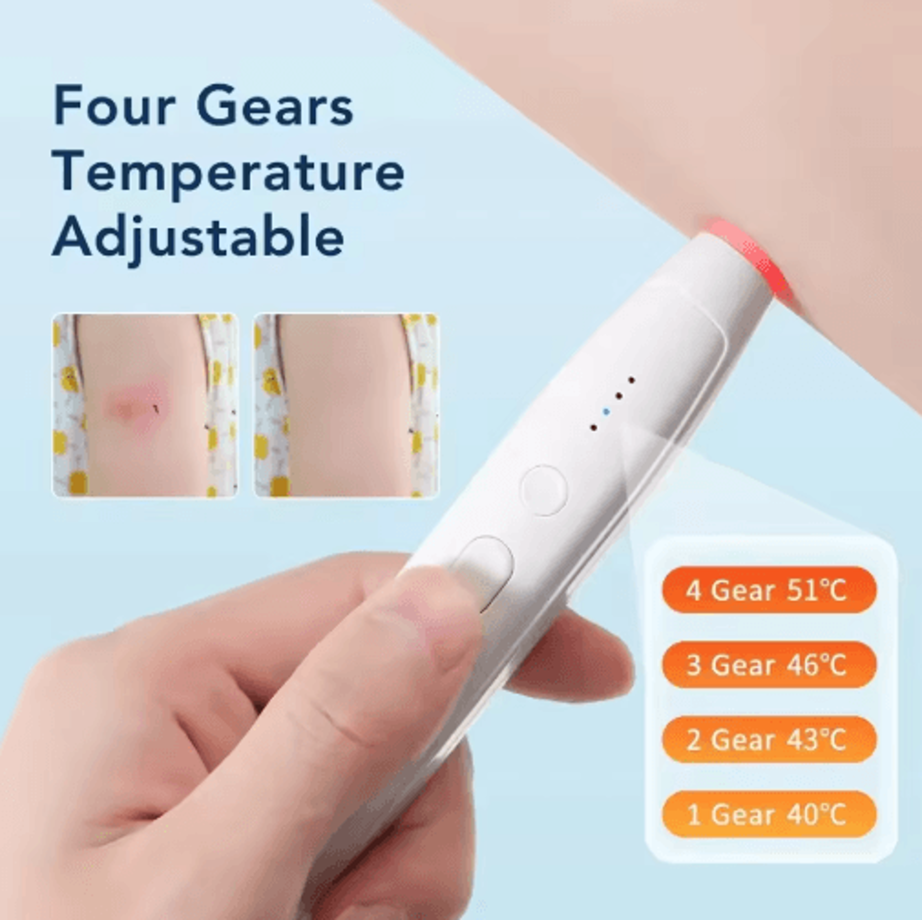 Portable Heated AntiItch Pen For Insect Bites 0