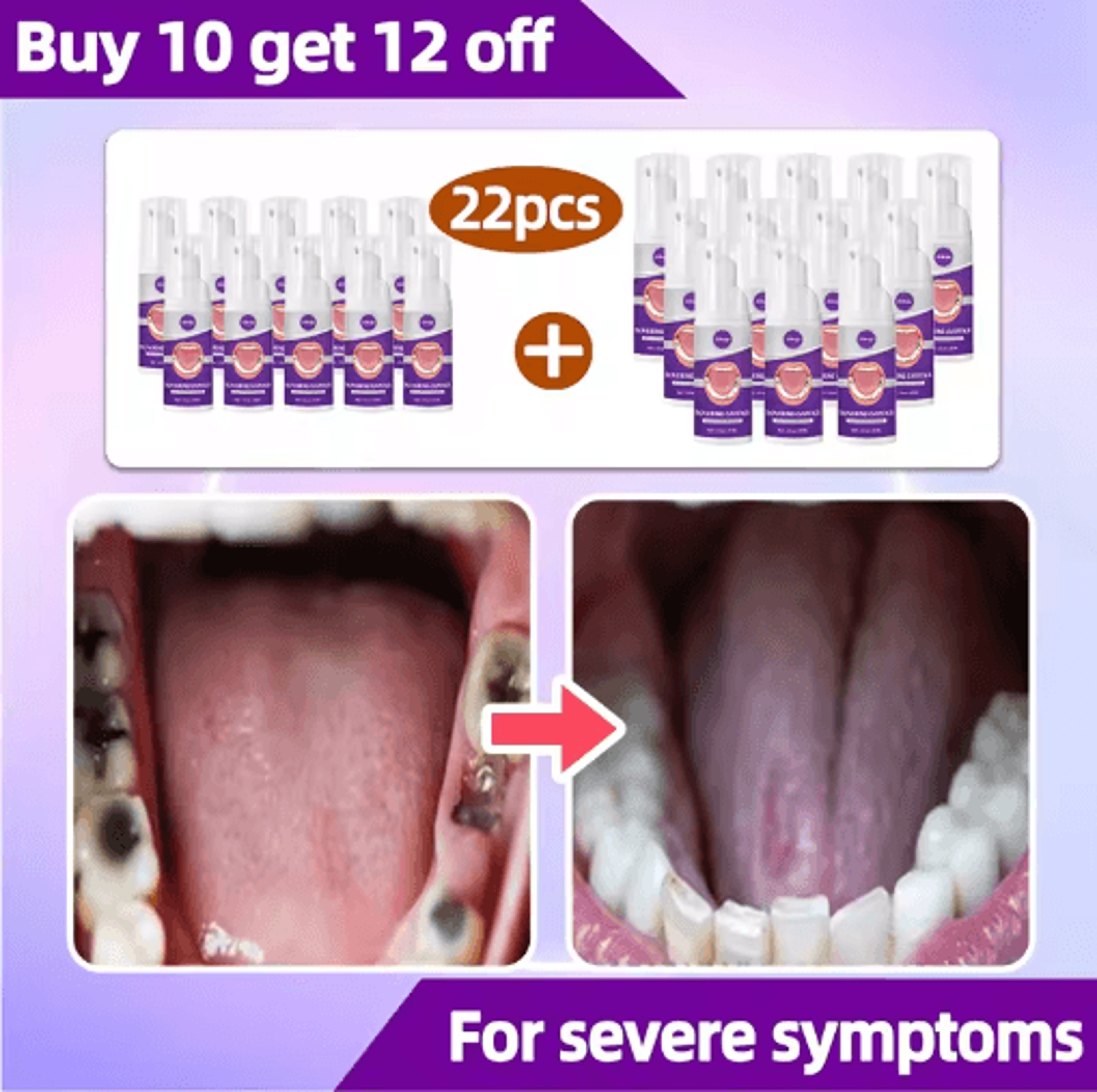 Targeted Tooth Care Product  Daily Cavity  Dental Care Support 1