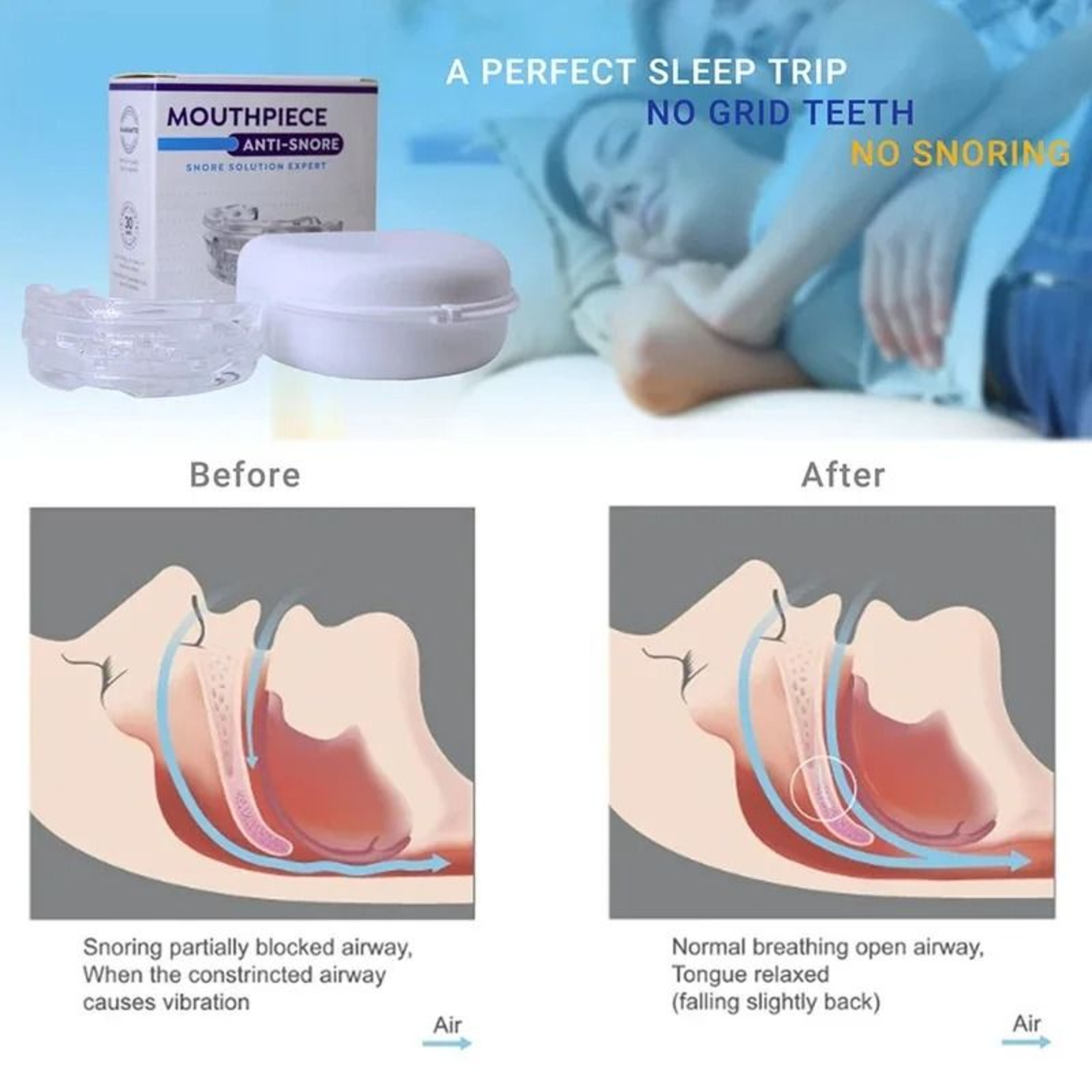 Anti Snoring Bruxism Mouth Guard With Storage Box For Better Sleep Quality 8