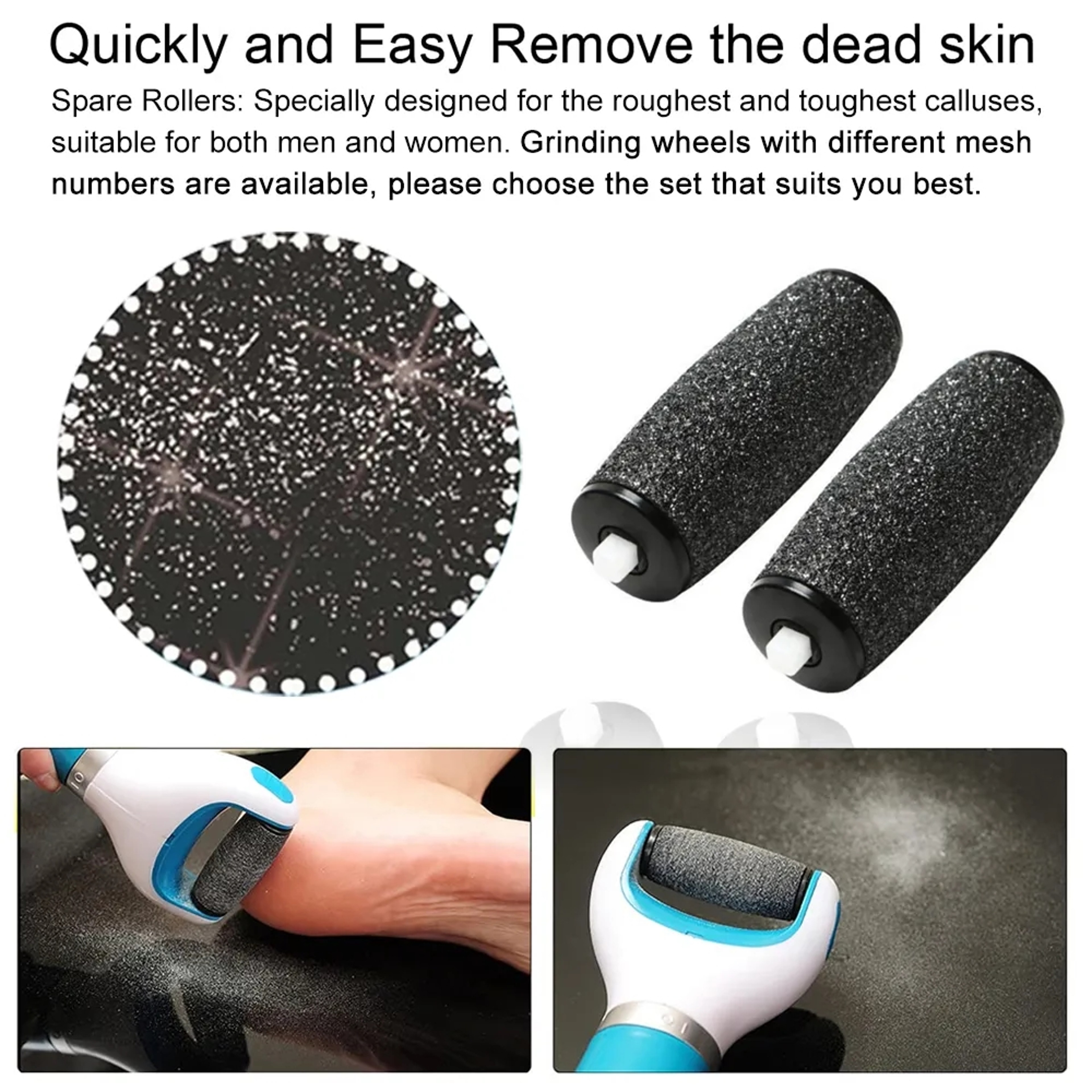 Electric Foot Care Device  Powerful Dead Skin Remover For Soft Smooth Feet 5