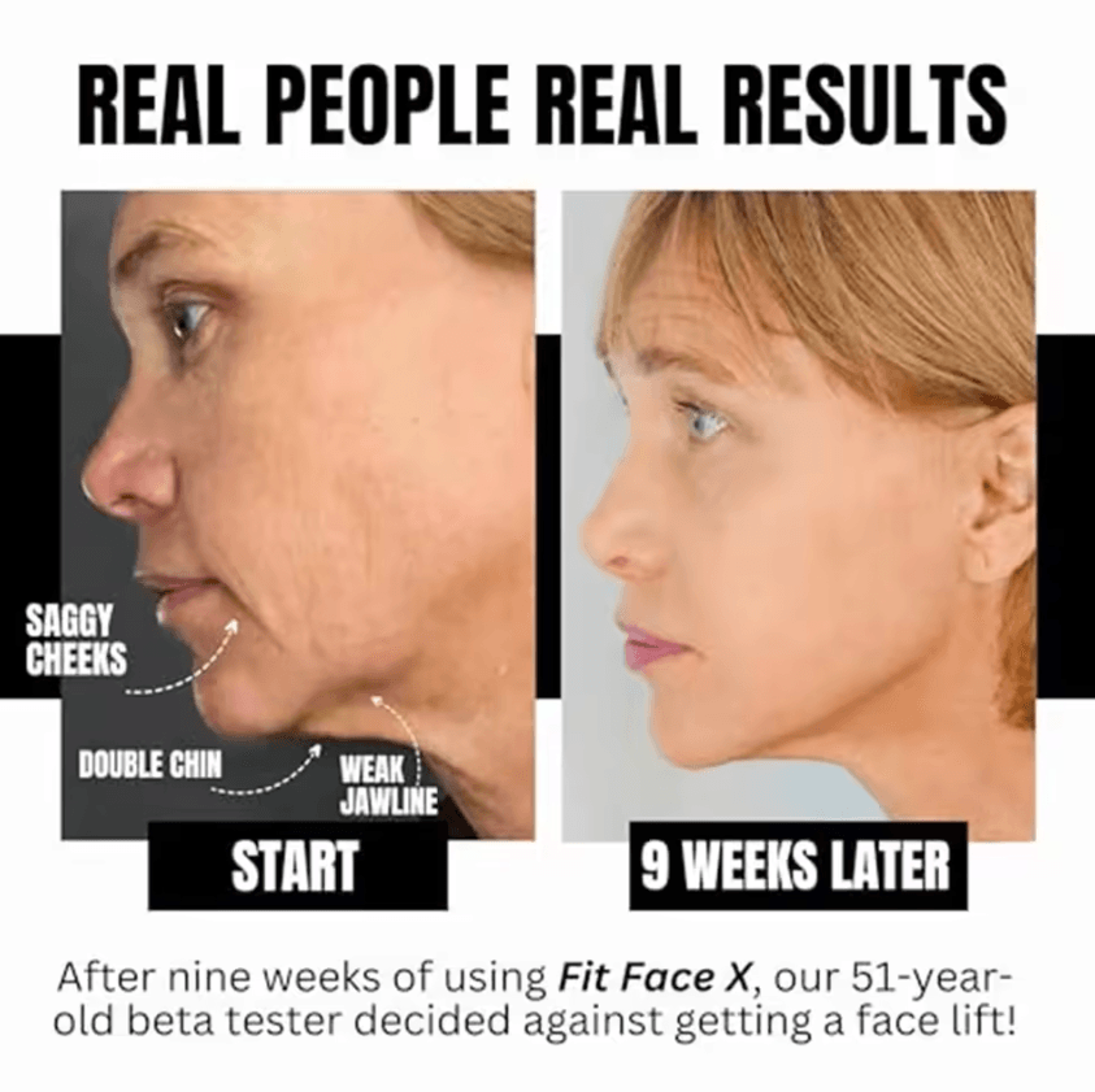 4in1 Face Sculpting Gym Kit  Jawline Cheek  Neck Toning Facial Exercise Tools 5