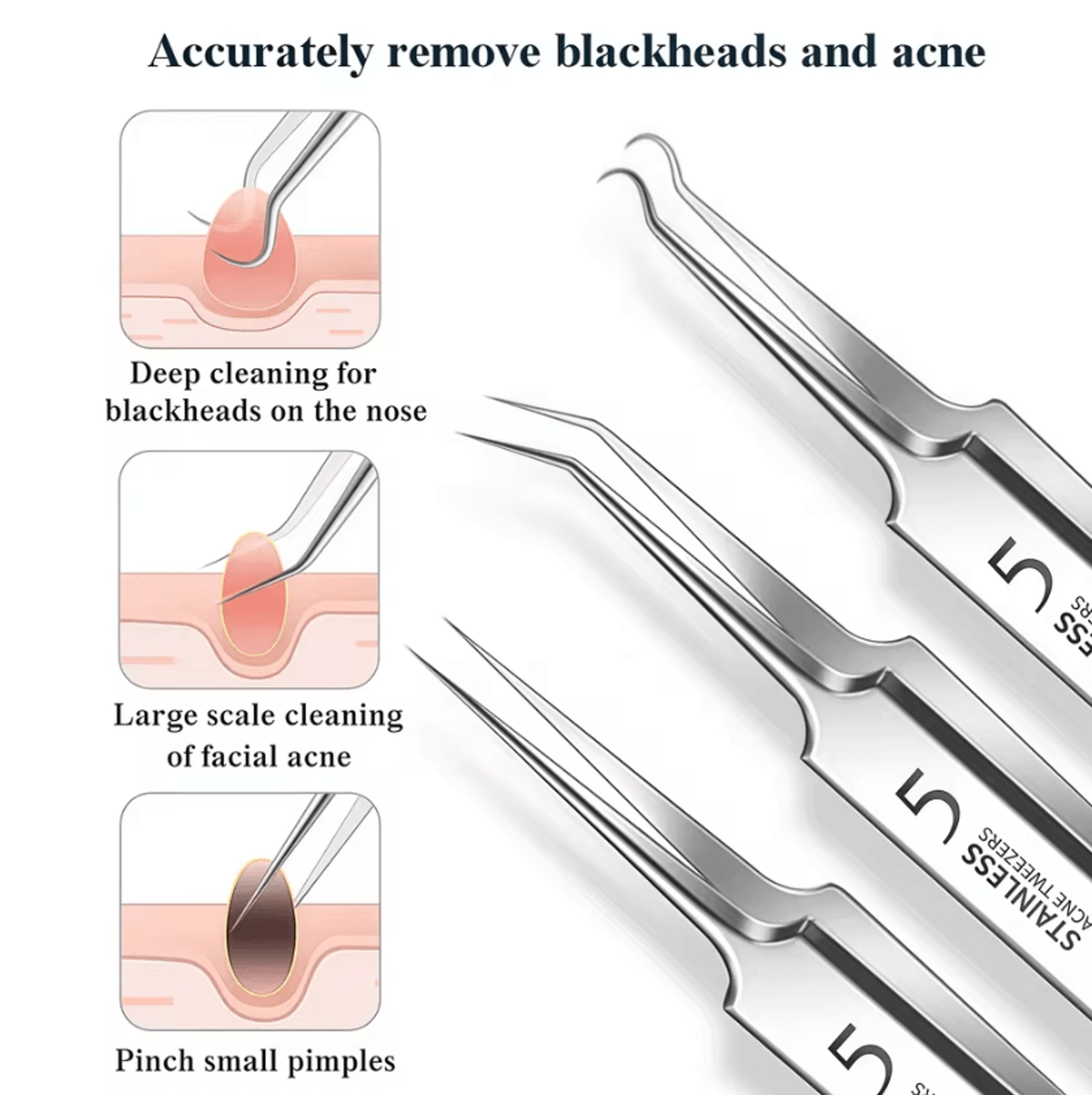 Professional Blackhead Removal Tool Kit Ingrown Hair Tweezers And Acne Extractor Set 1