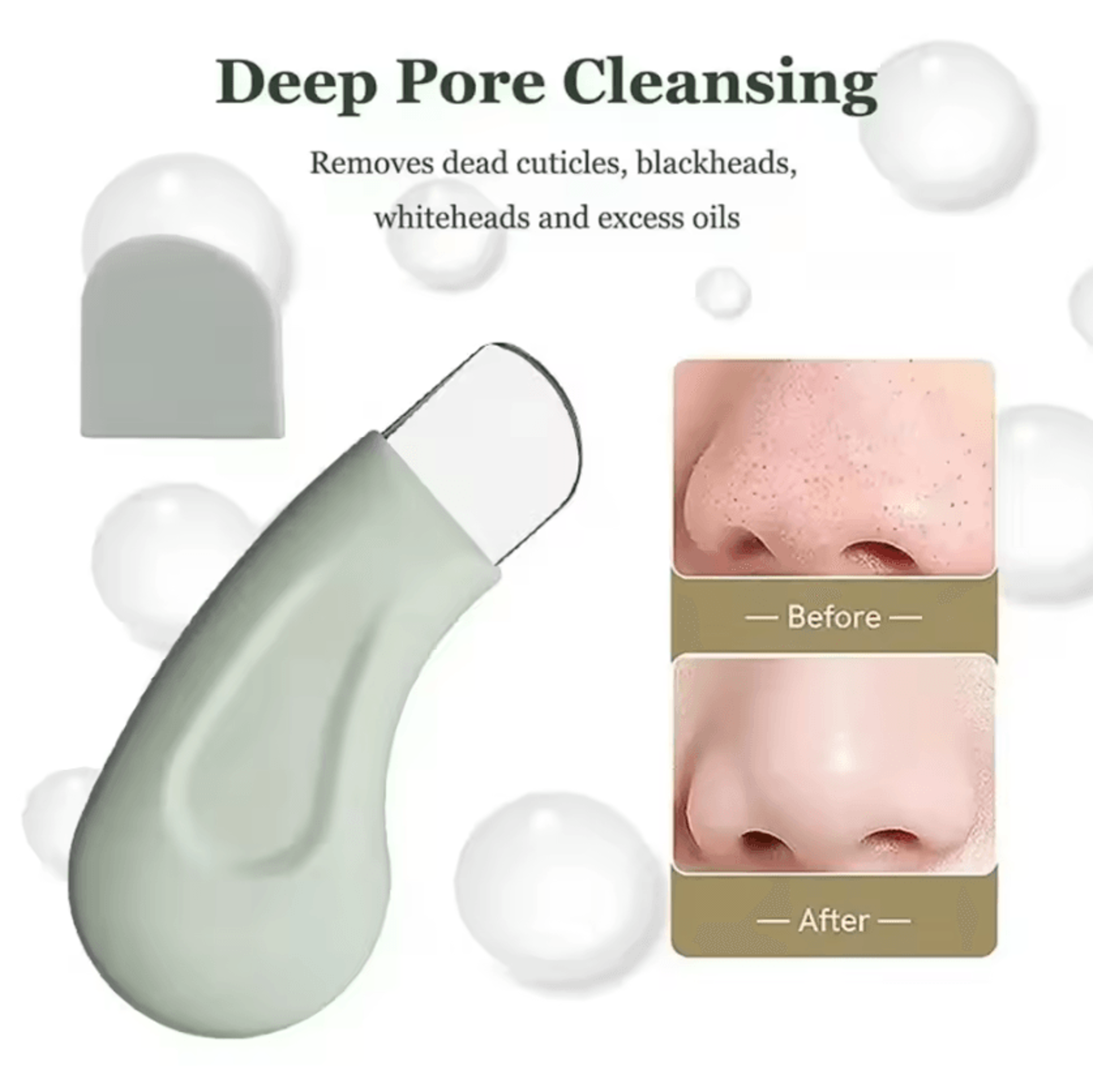 Deep Cleansing Blackhead Remover Tool For Nose And Face Pore Cleaner 1