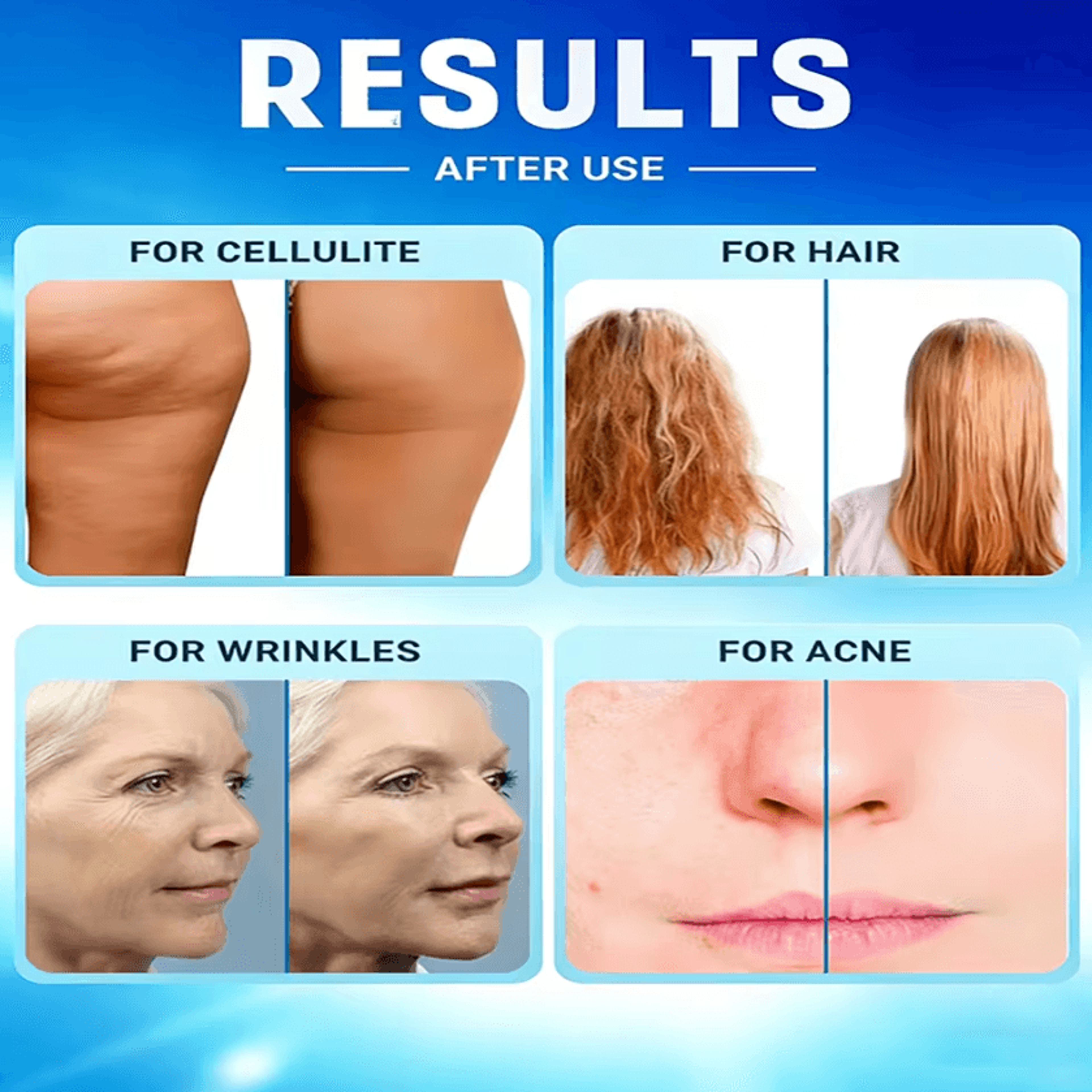 4 In 1 High Frequency Facial Wand With Glass Electrodes For Acne Care And Skin Rejuvenation 3