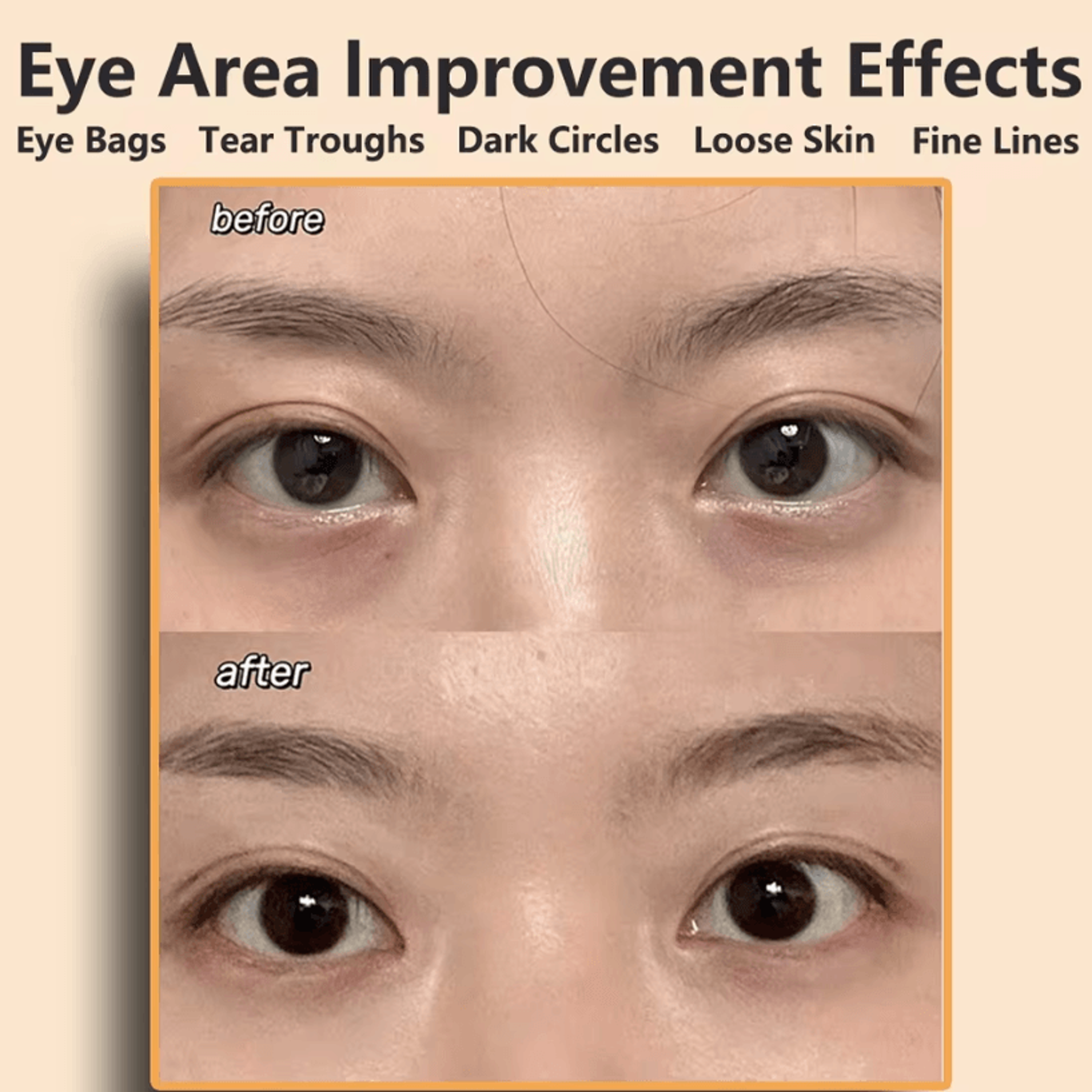 EMS Facial Massager  Eye And Face Lifting Beauty And AntiWrinkle Device 1