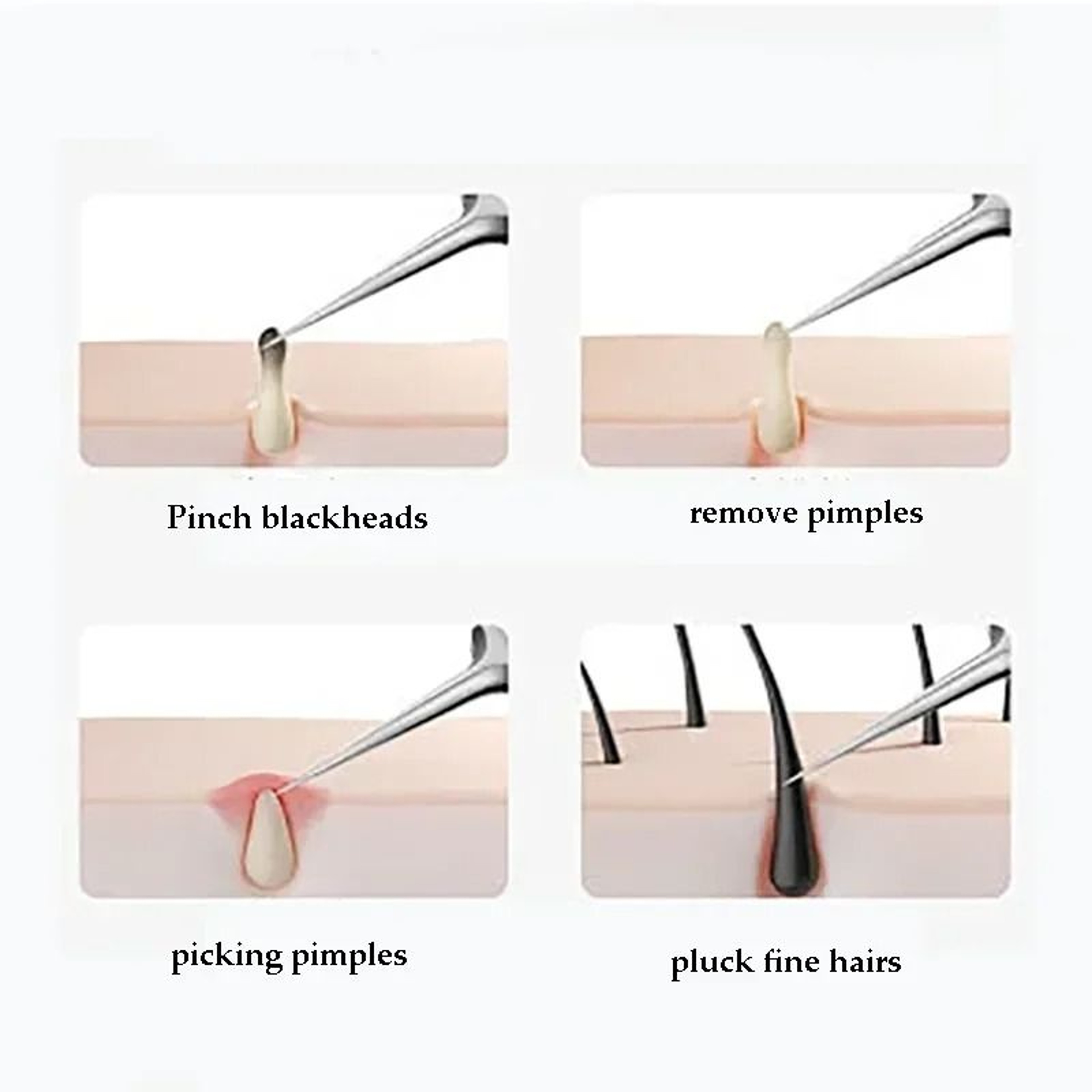 Precision Stainless Steel Facial Extraction And Blemish Removal Tool Kit 3