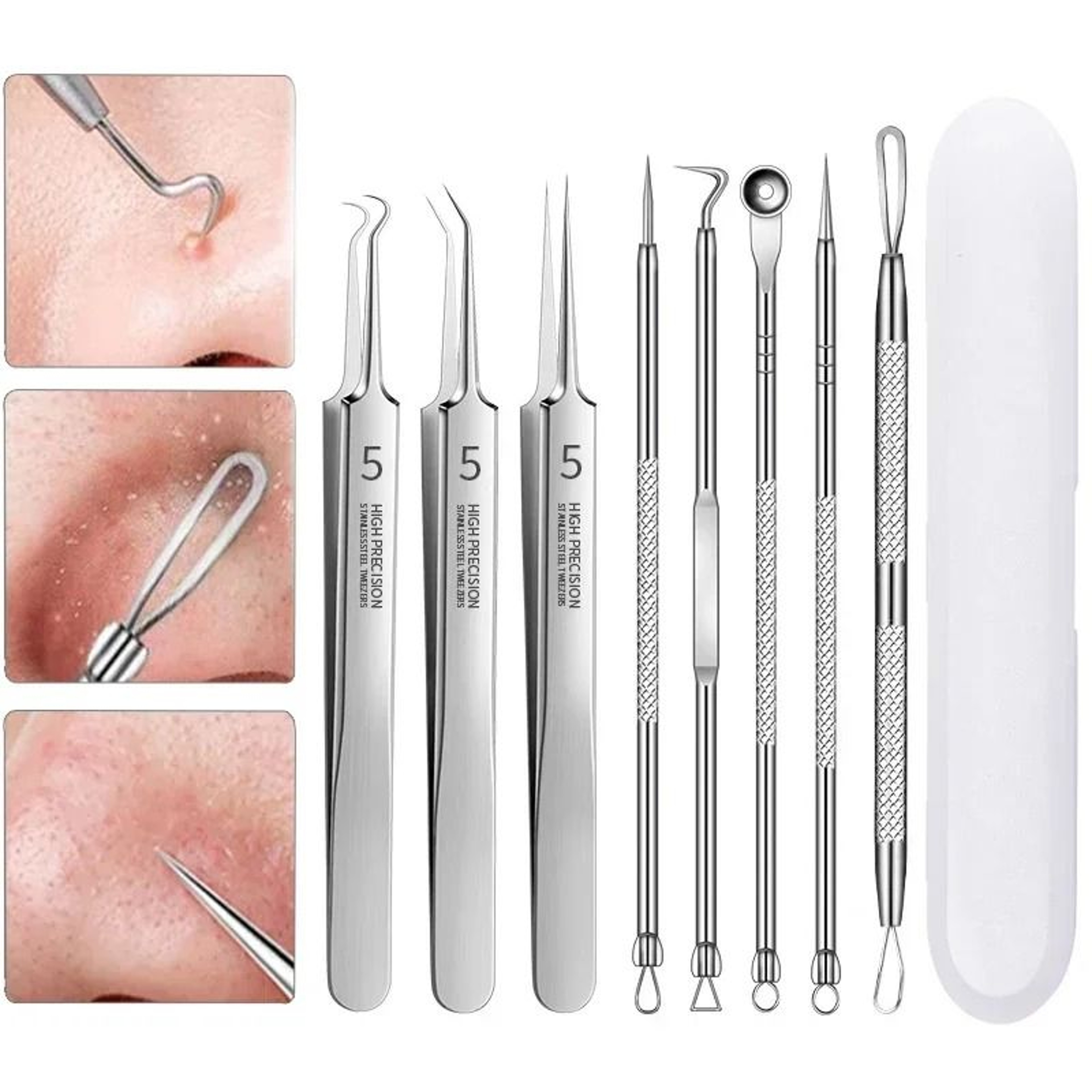 Stainless Steel Precision Blemish Extraction And Deep Pore Cleansing Set 1