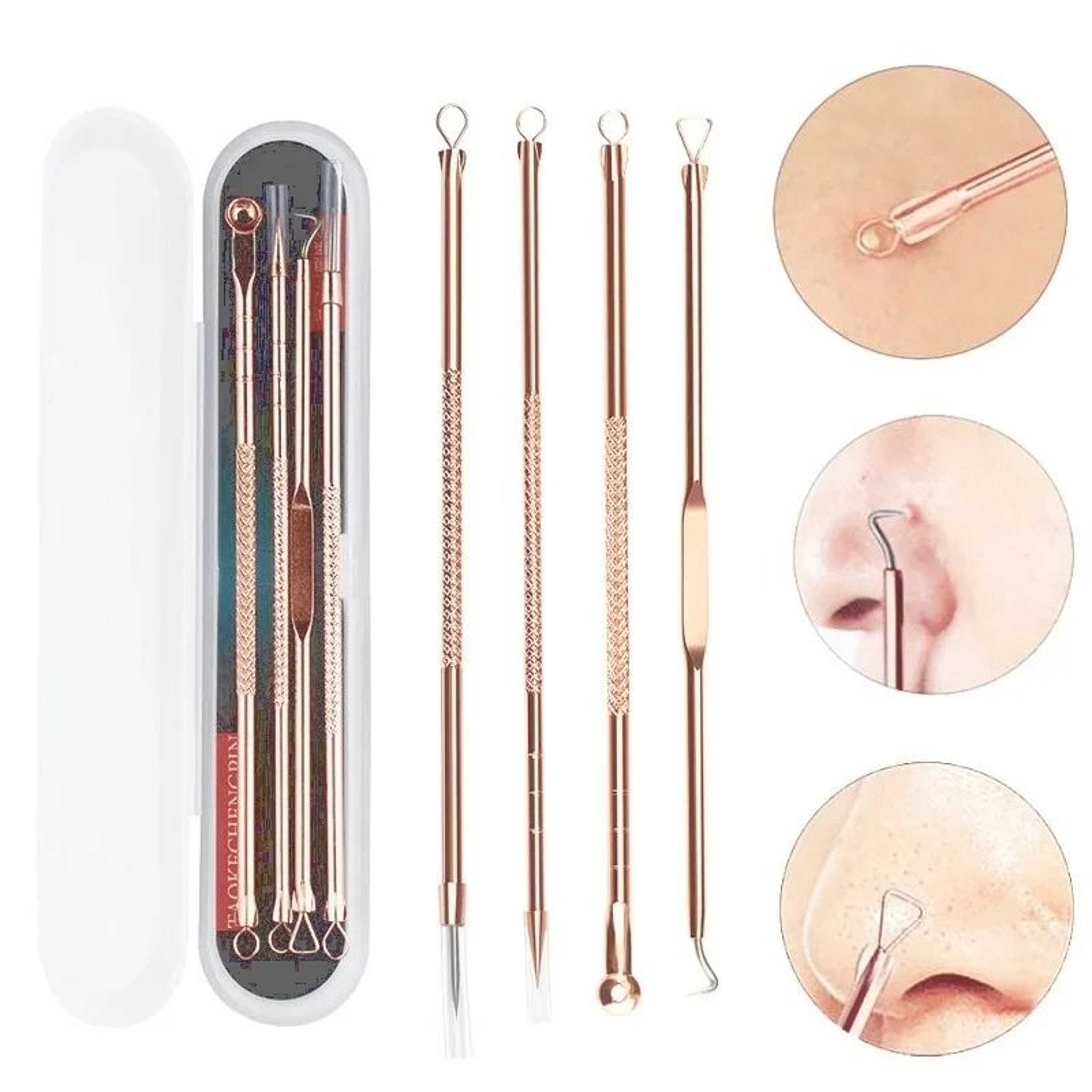 Stainless Steel Pimple Extractor And Whitehead Comedone Removal Kit 1