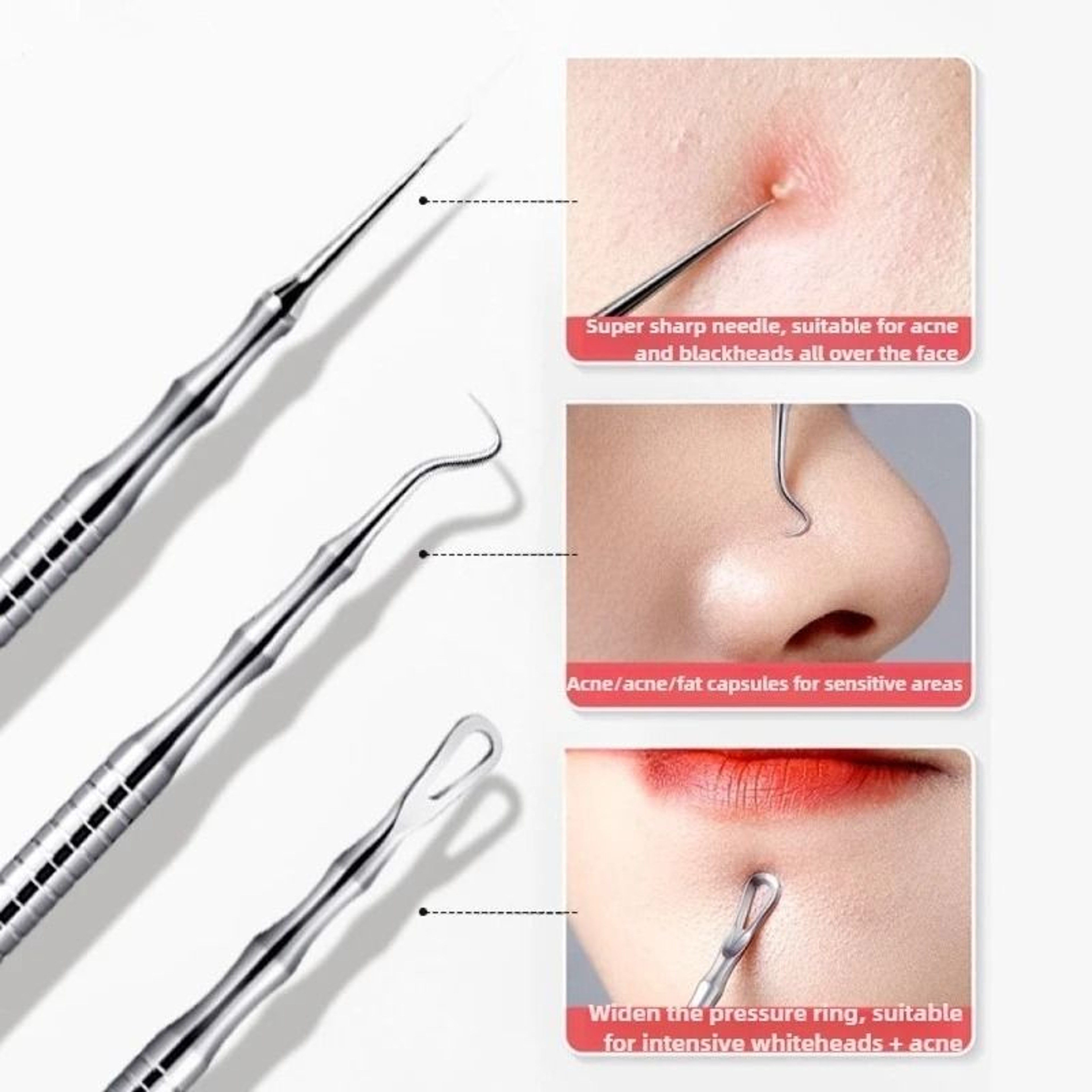 Precision German Engineering Acne Extraction Needles And Ultra Fine Blackhead Tweezer Tool 2
