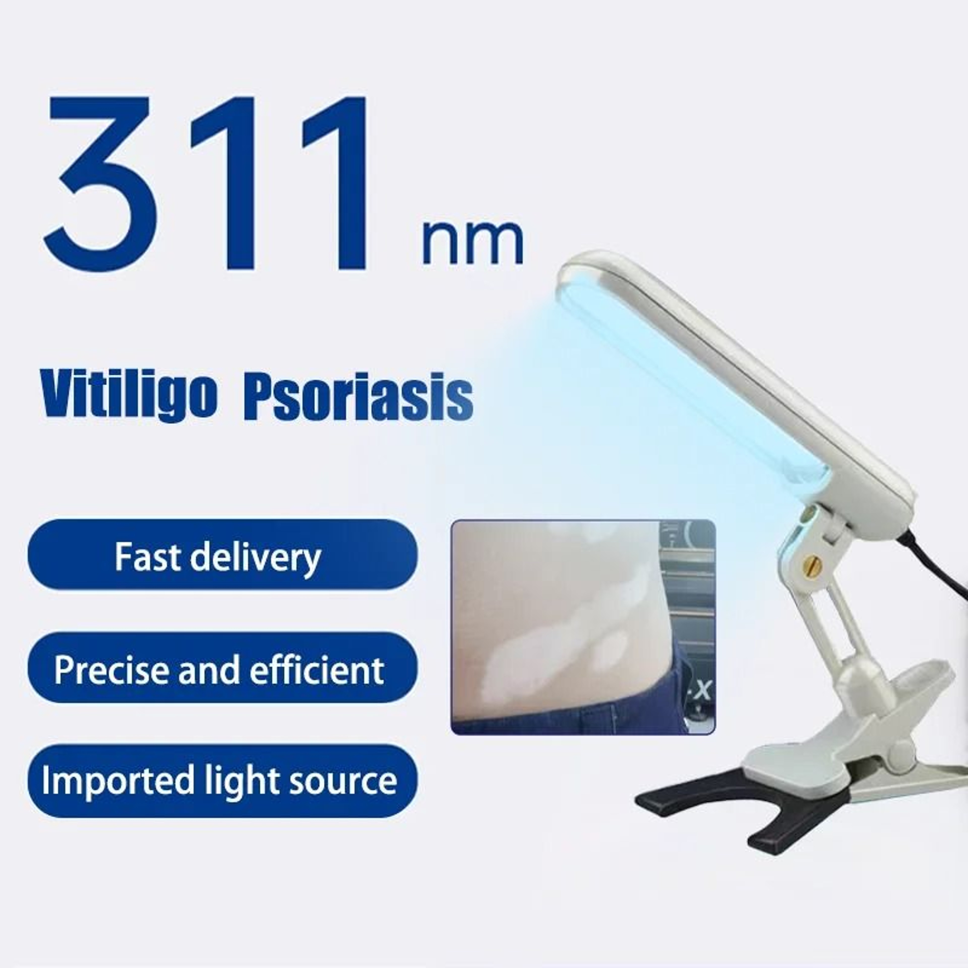 311nm Narrowband UVB Medical Grade Phototherapy Lamp For Skin Health Management 0