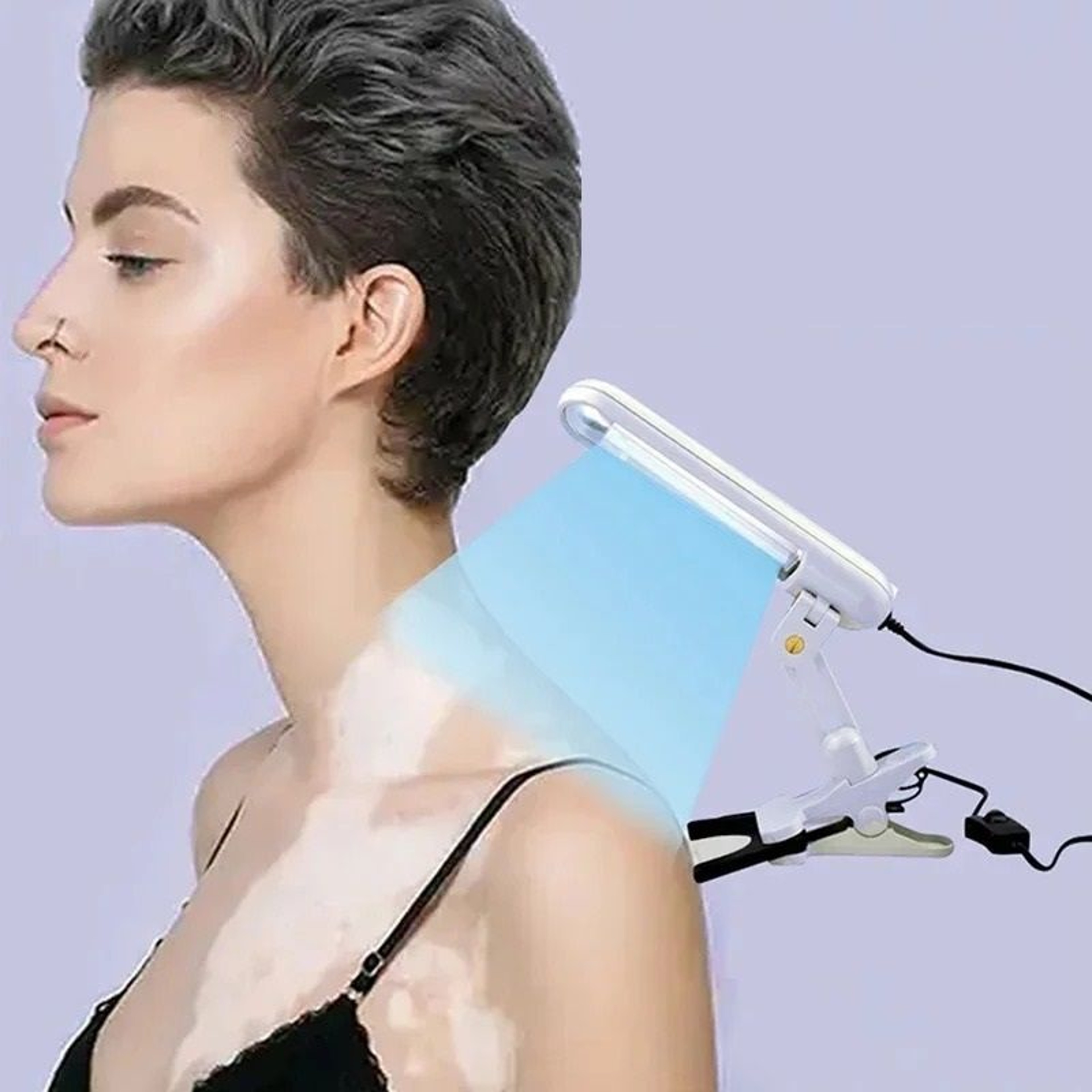 Targeted Narrowband UVB Phototherapy Lamp For Skin Care Maintenance 0