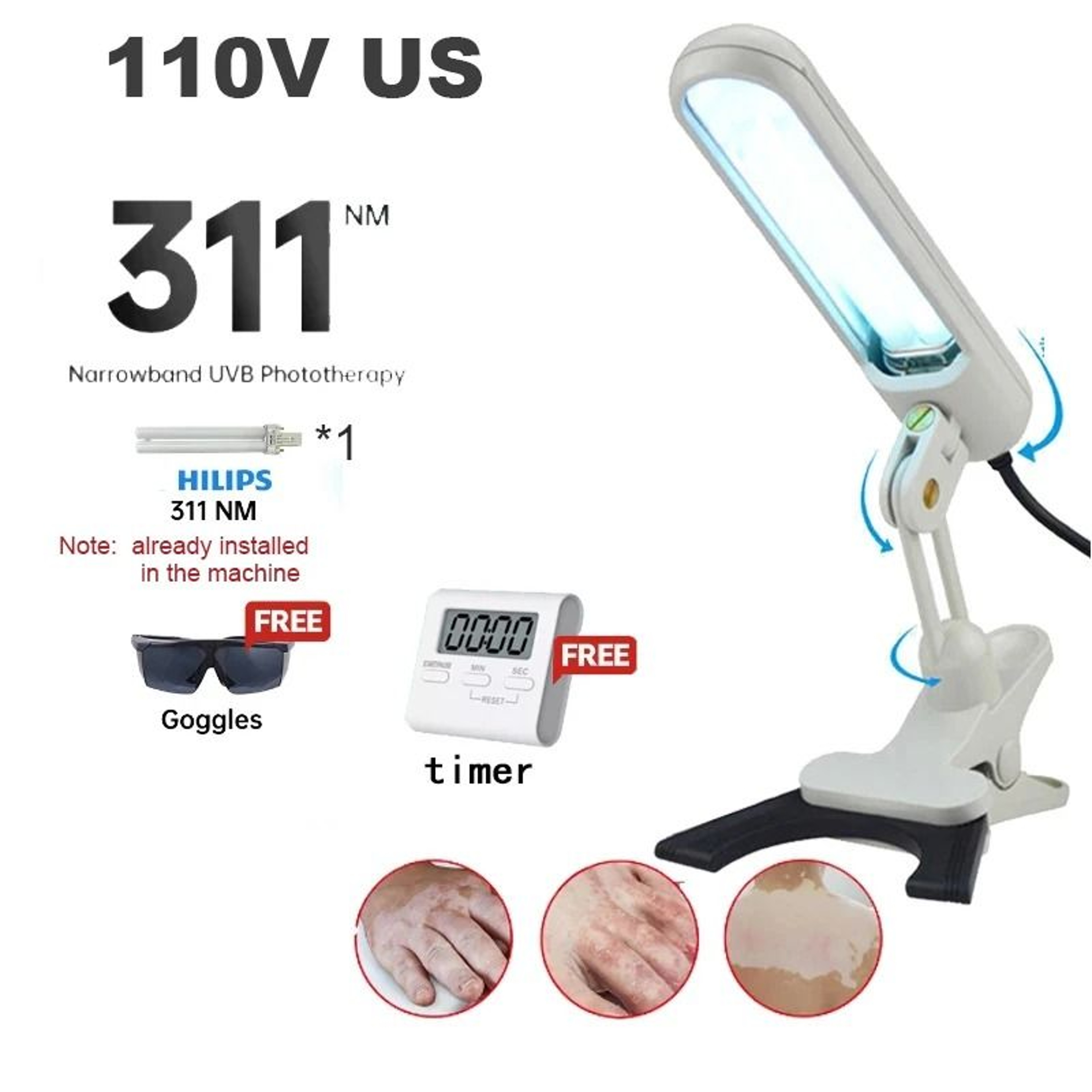 Targeted Narrowband UVB Phototherapy Lamp For Skin Care Maintenance 5