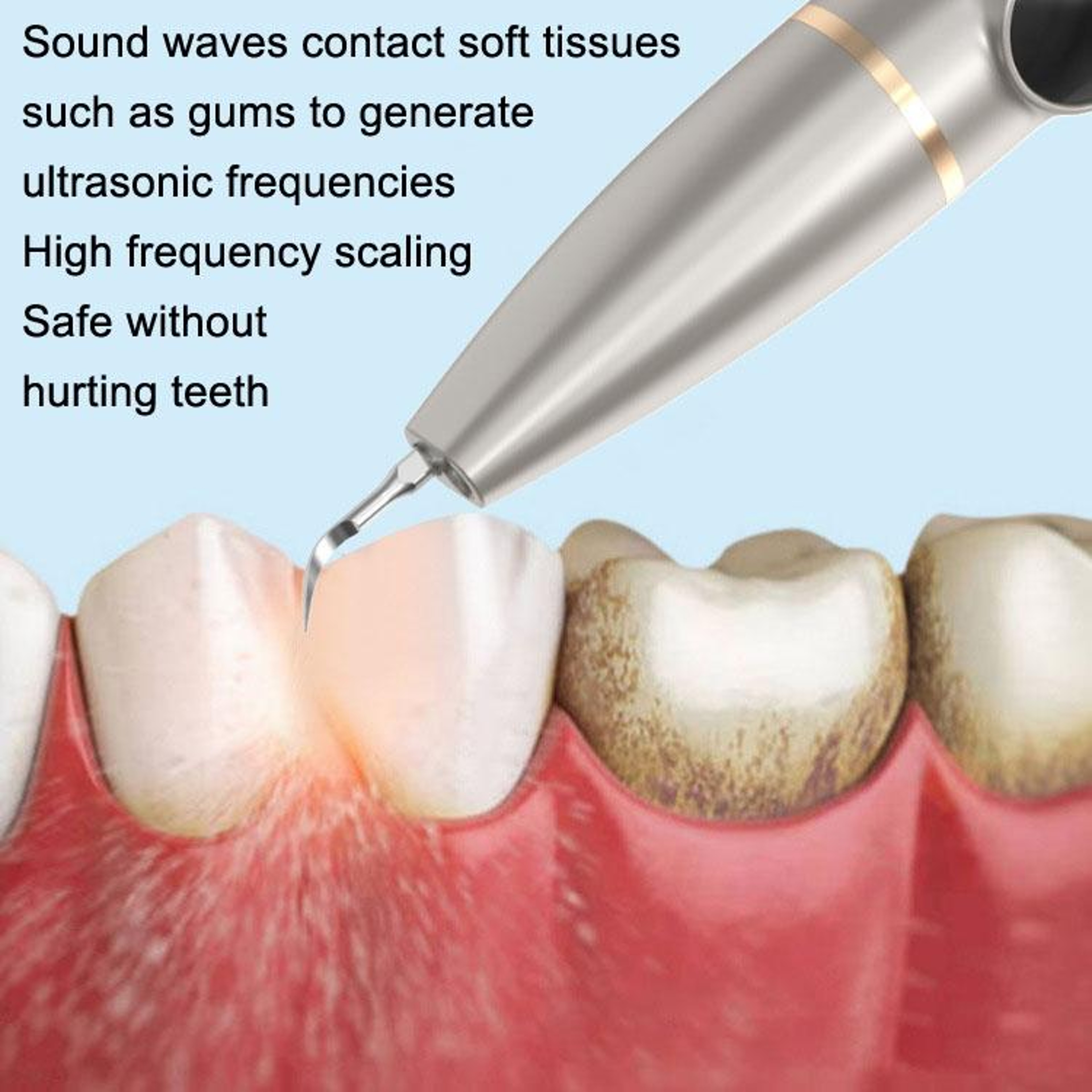 Ultrasonic Dental Scaler With Camera Electric Tartar Remover For Safe Teeth Cleaning 2