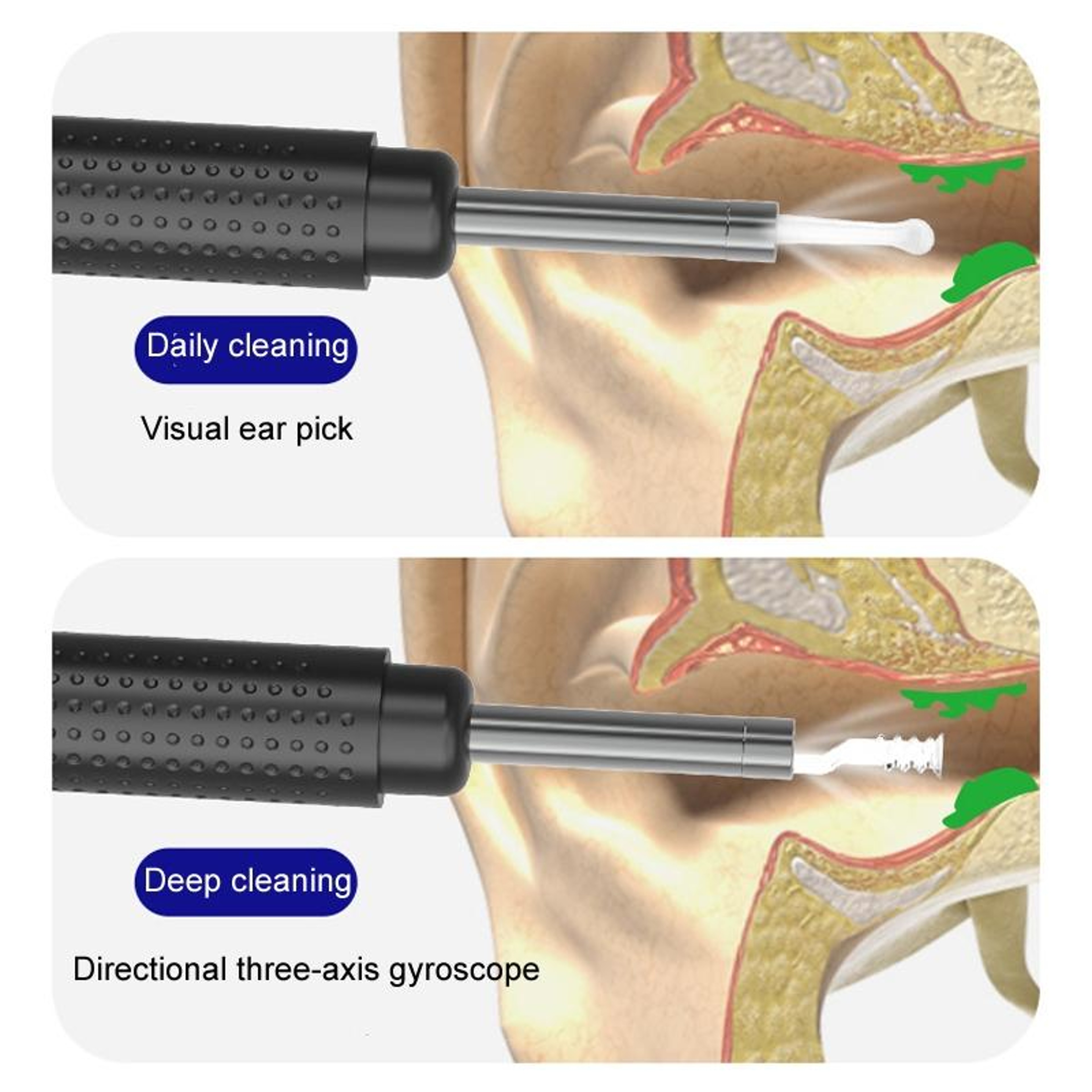 WiFi Ear Wax Removal Tool with Camera HD Ear Cleaning Endoscope – view 5