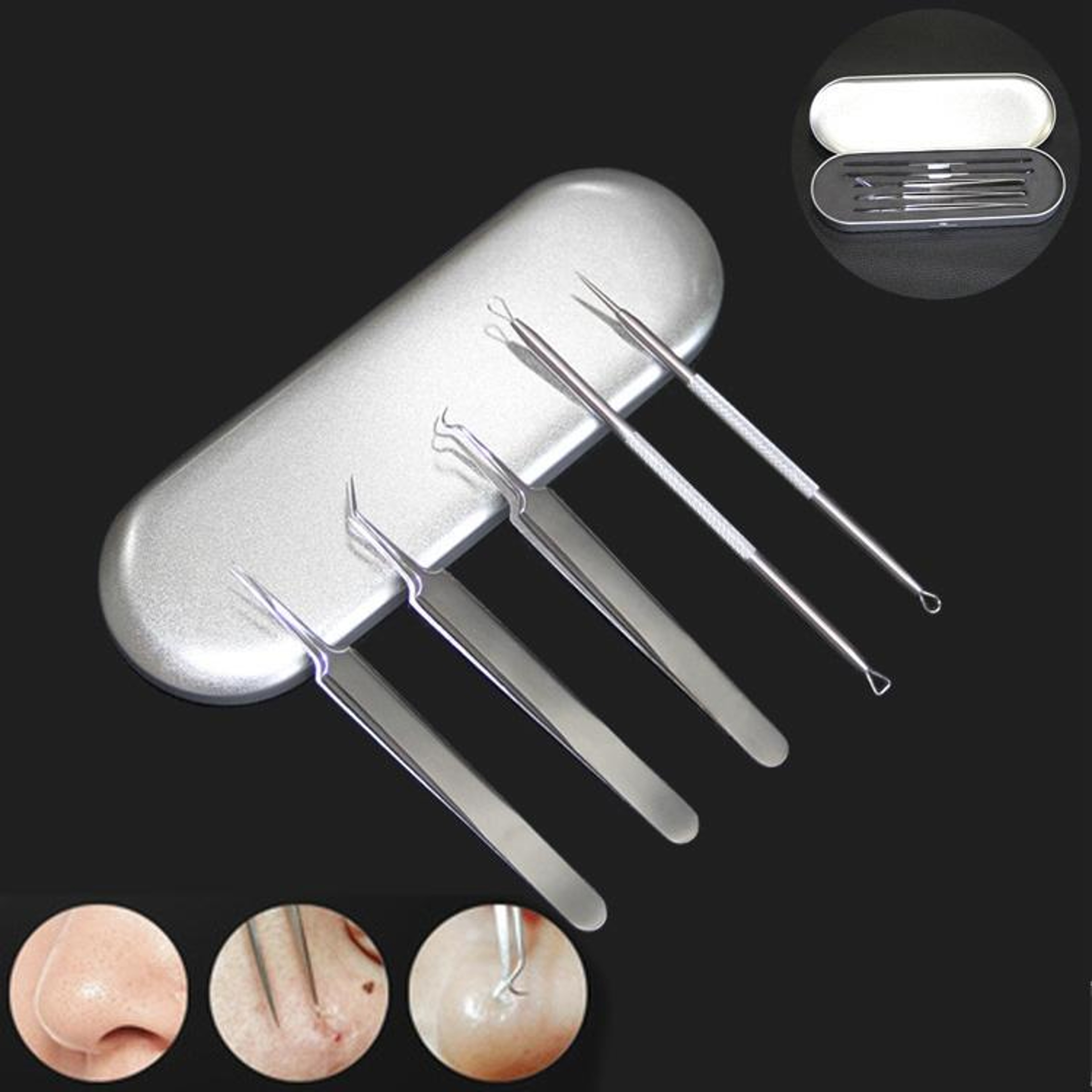 Professional Blackhead Remover Kit Blackhead Extractor Tool Set For Acne  Pimple Care 1