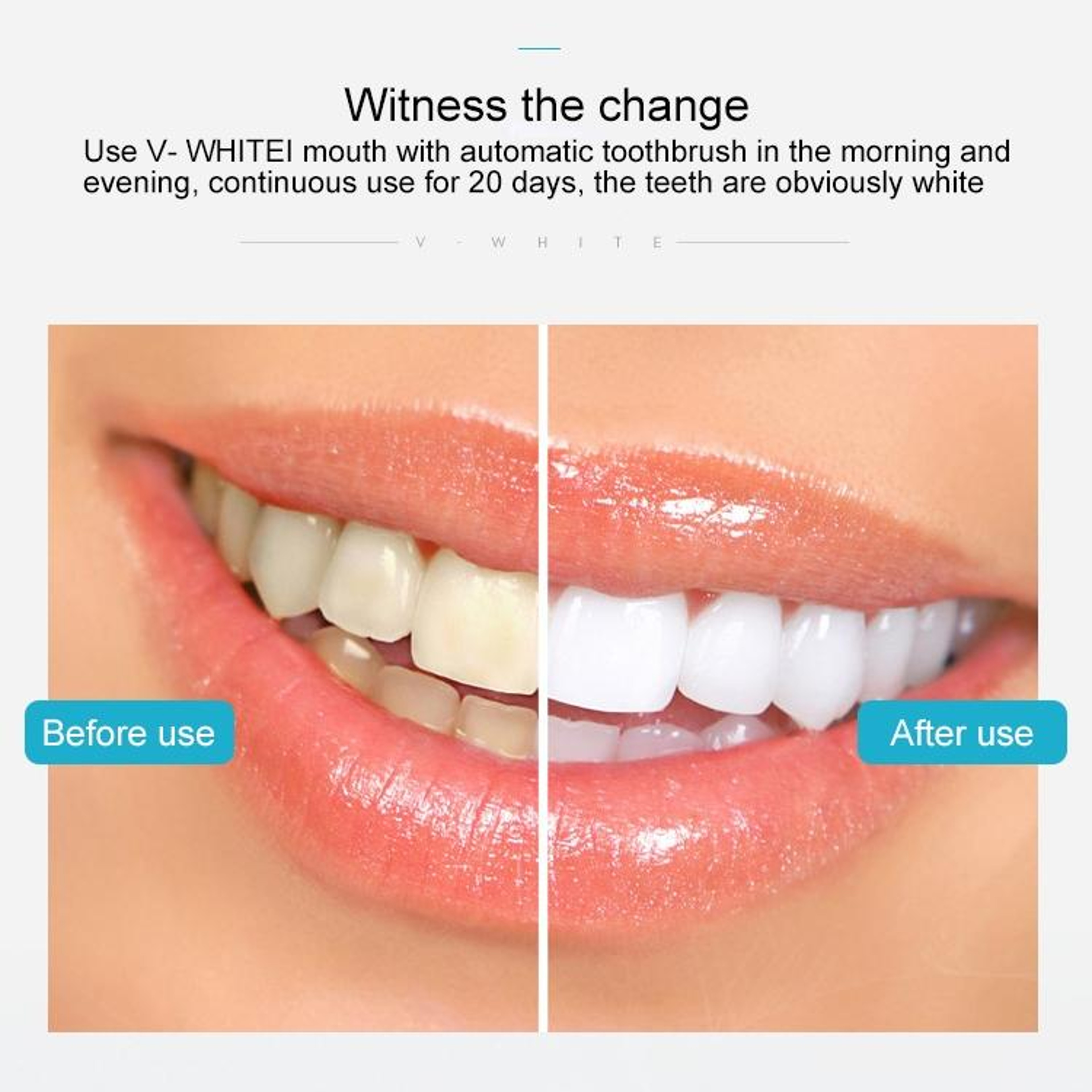 360 Automatic Silicone Electric Toothbrush With 3 Modes For Deep Clean  Gum Care 3