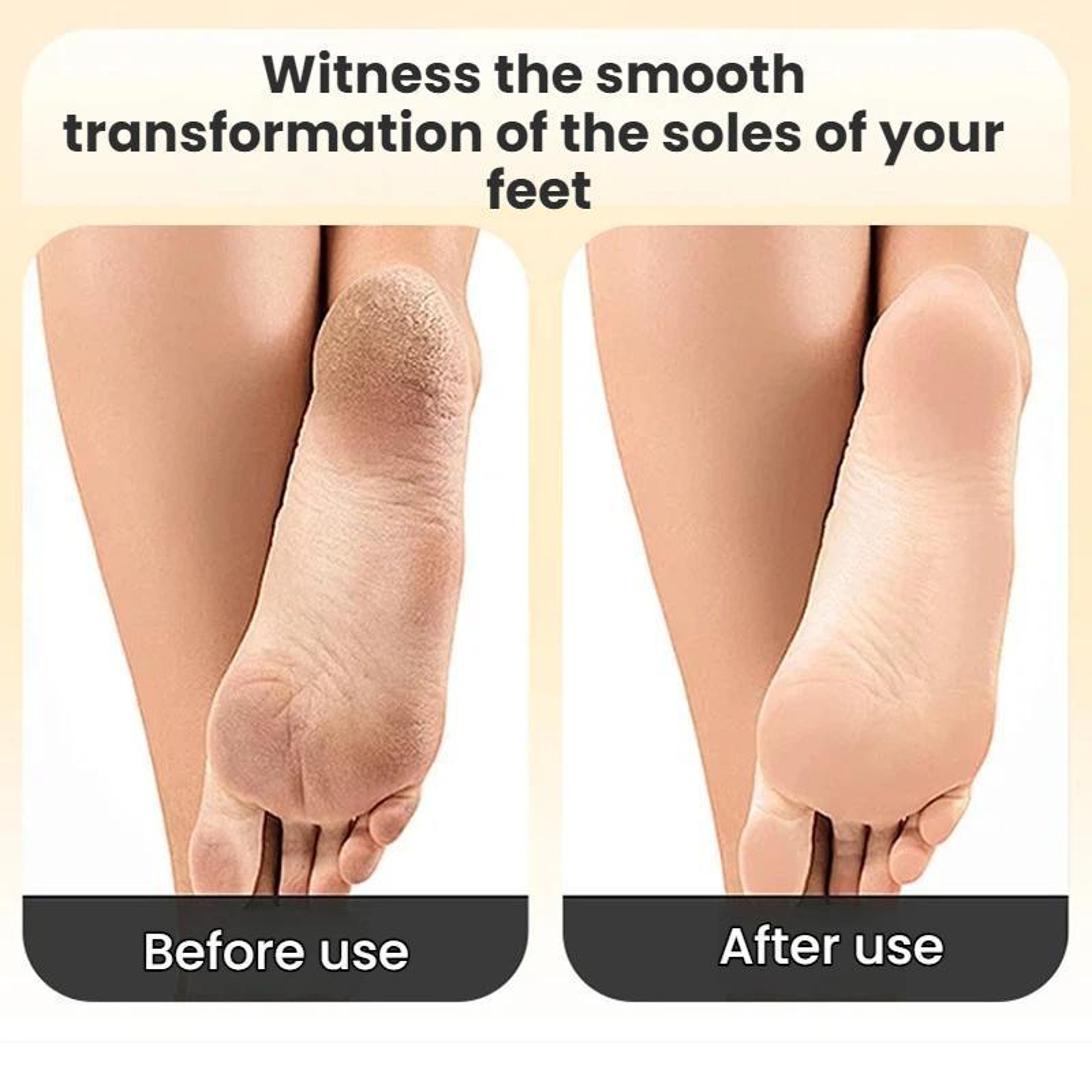 Premium Electric Foot File  Automatic Callus Remover For Feet Gentle Home Foot Care Tool 7